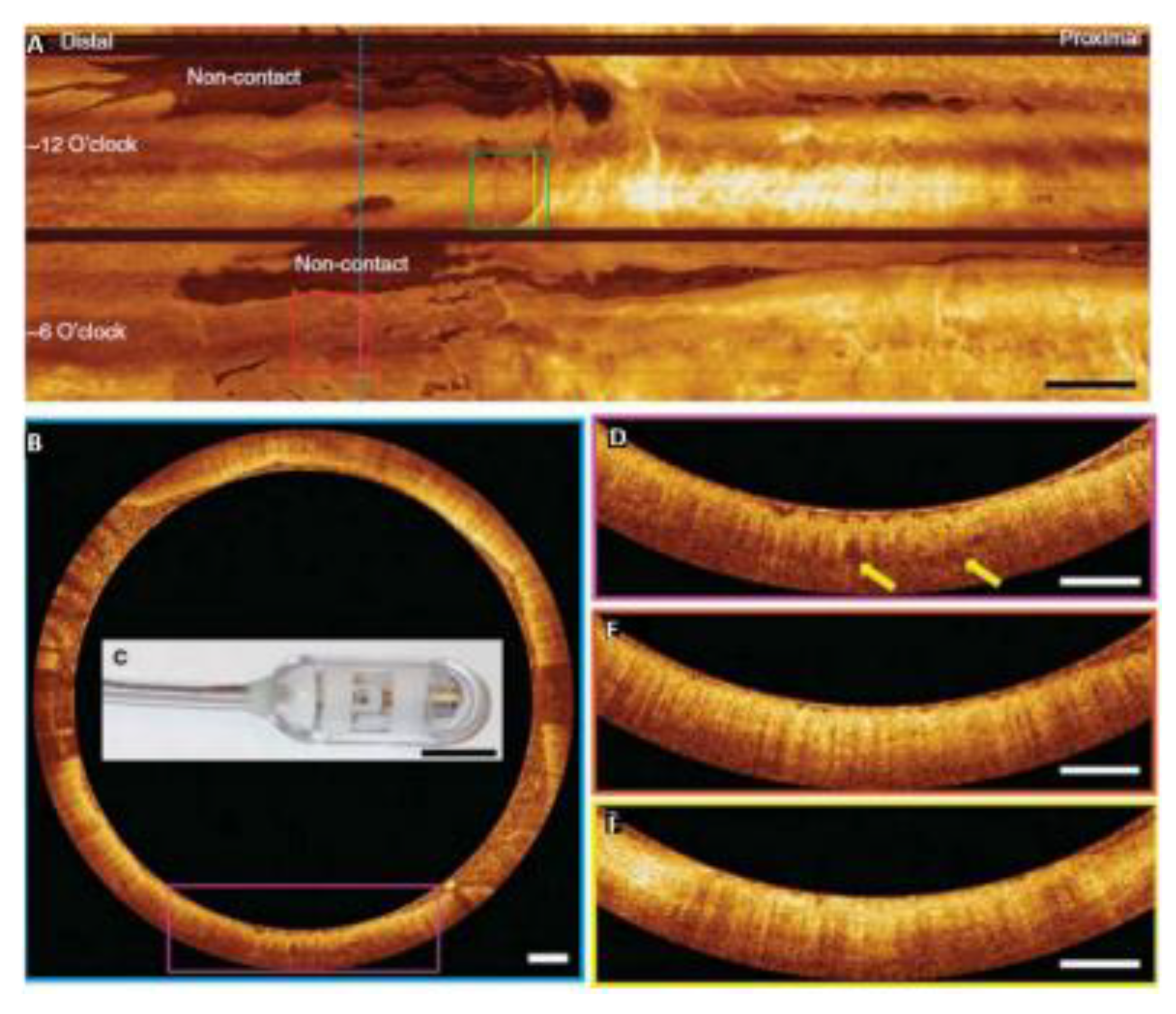 Photonics 10 00051 g004 Photonics 10 00051 g004
