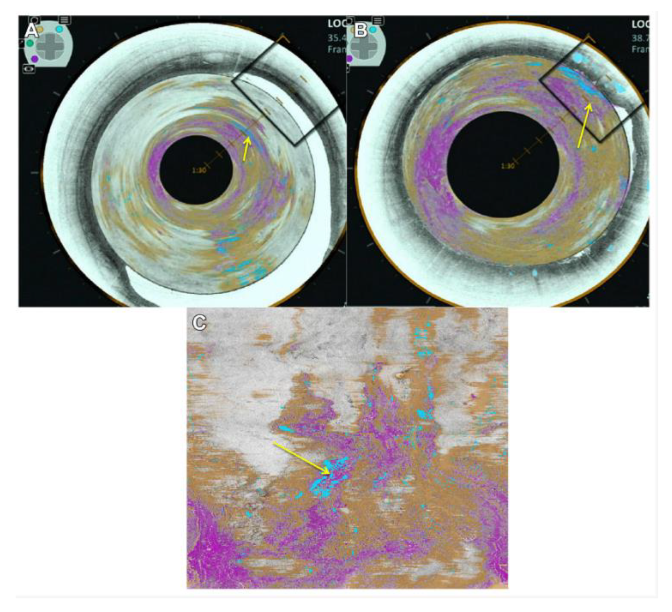 Photonics 10 00051 g007 Photonics 10 00051 g007