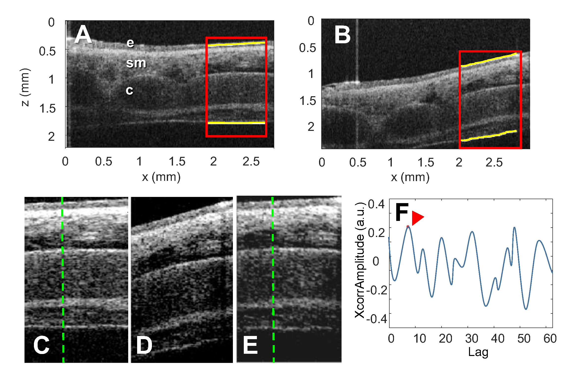 Photonics 10 00051 g011 Photonics 10 00051 g011