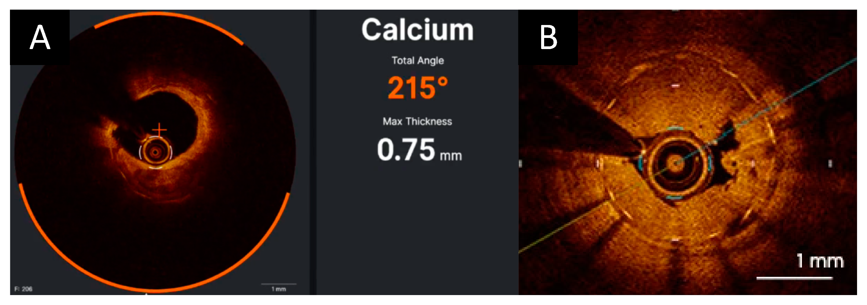 Photonics 10 00158 g004 Photonics 10 00158 g004
