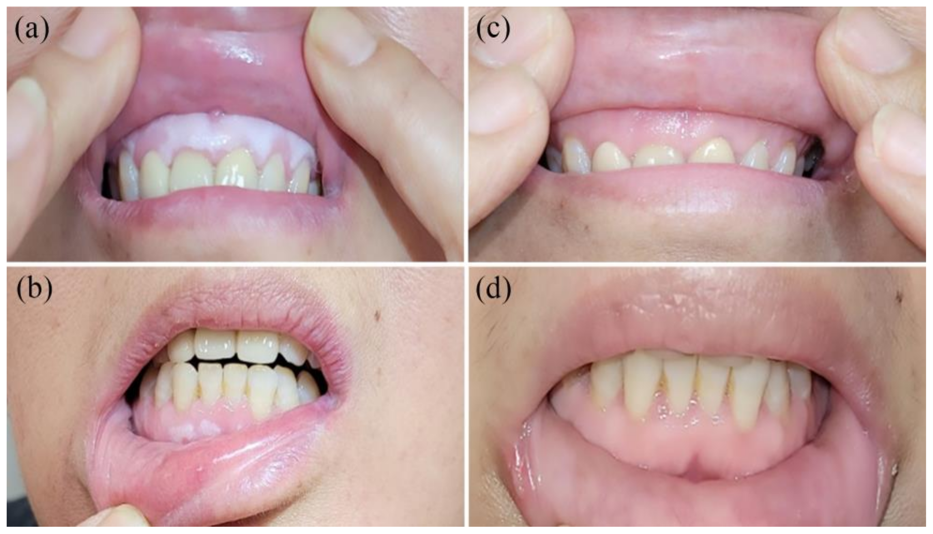 Photonics 10 00241 g004