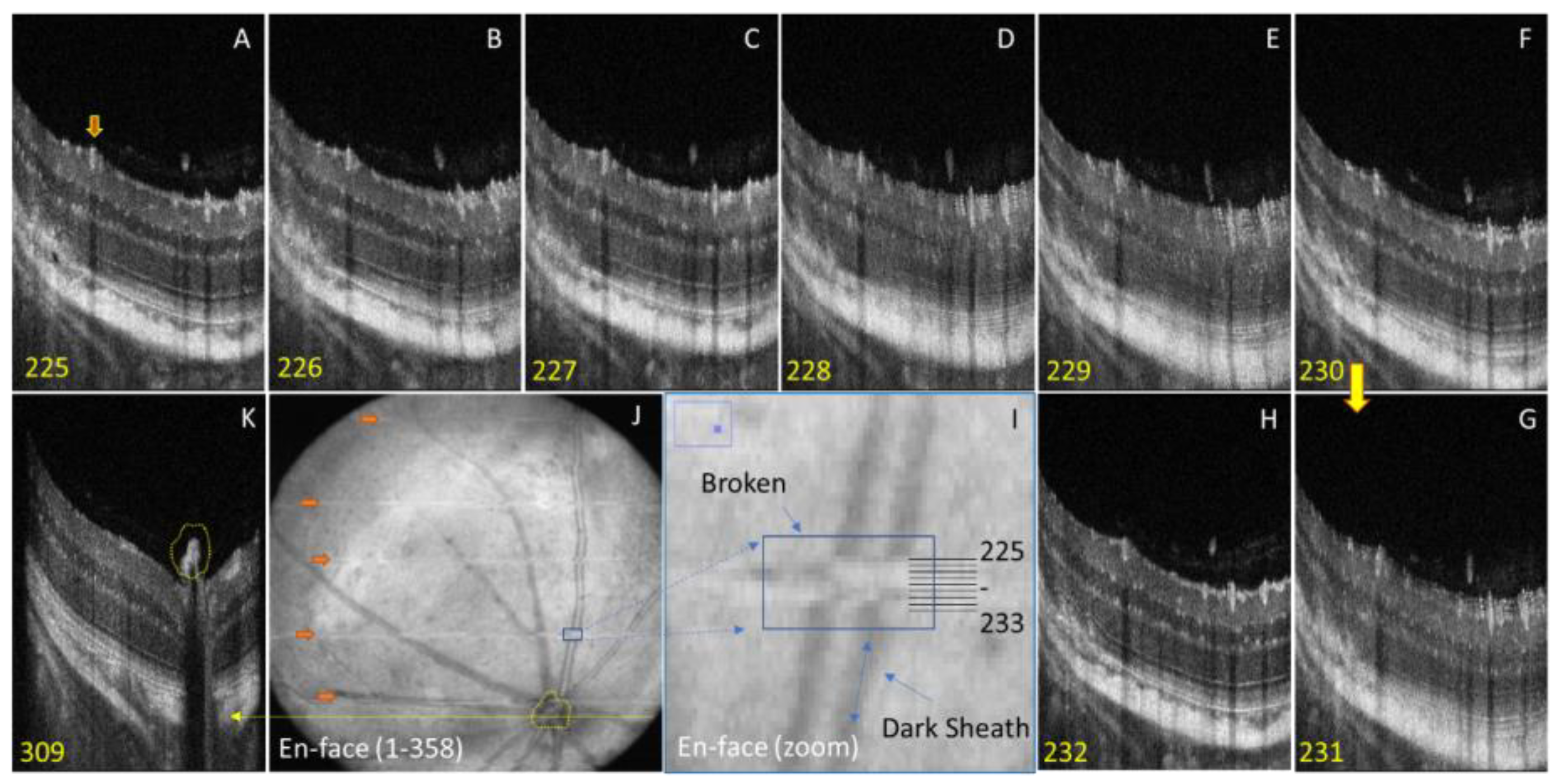 Photonics 10 00275 g002 Photonics 10 00275 g002