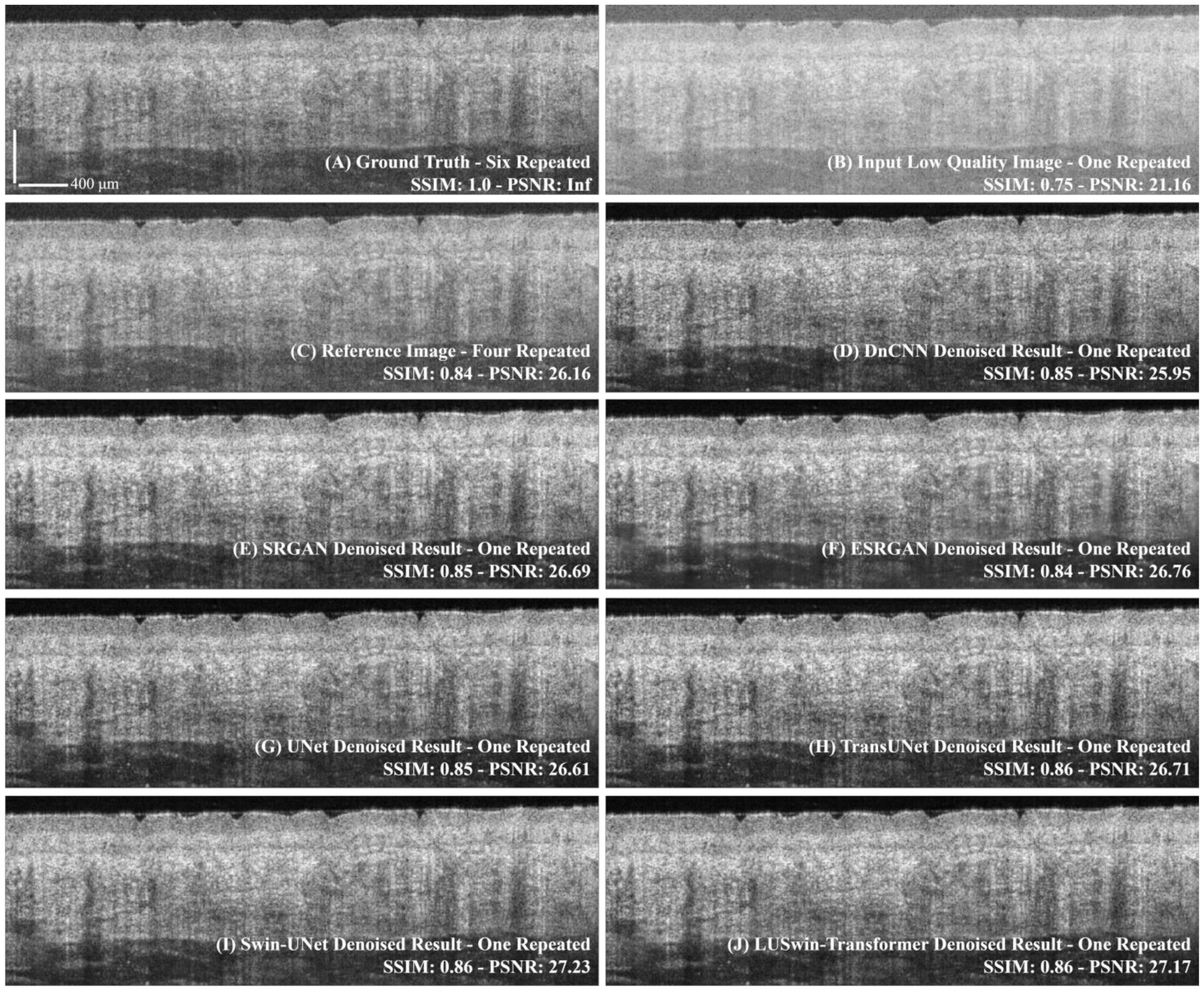 Photonics 10 00468 g004 Photonics 10 00468 g004