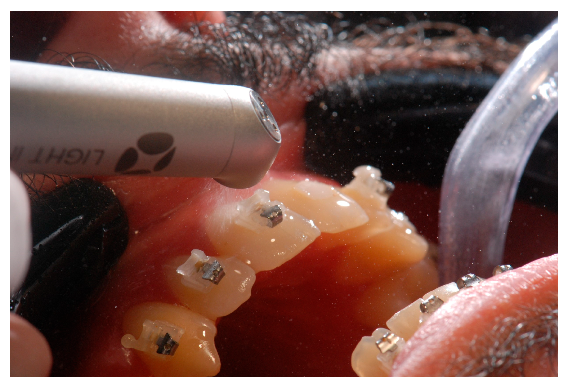 Photonics 10 00689 g009 Photonics 10 00689 g009