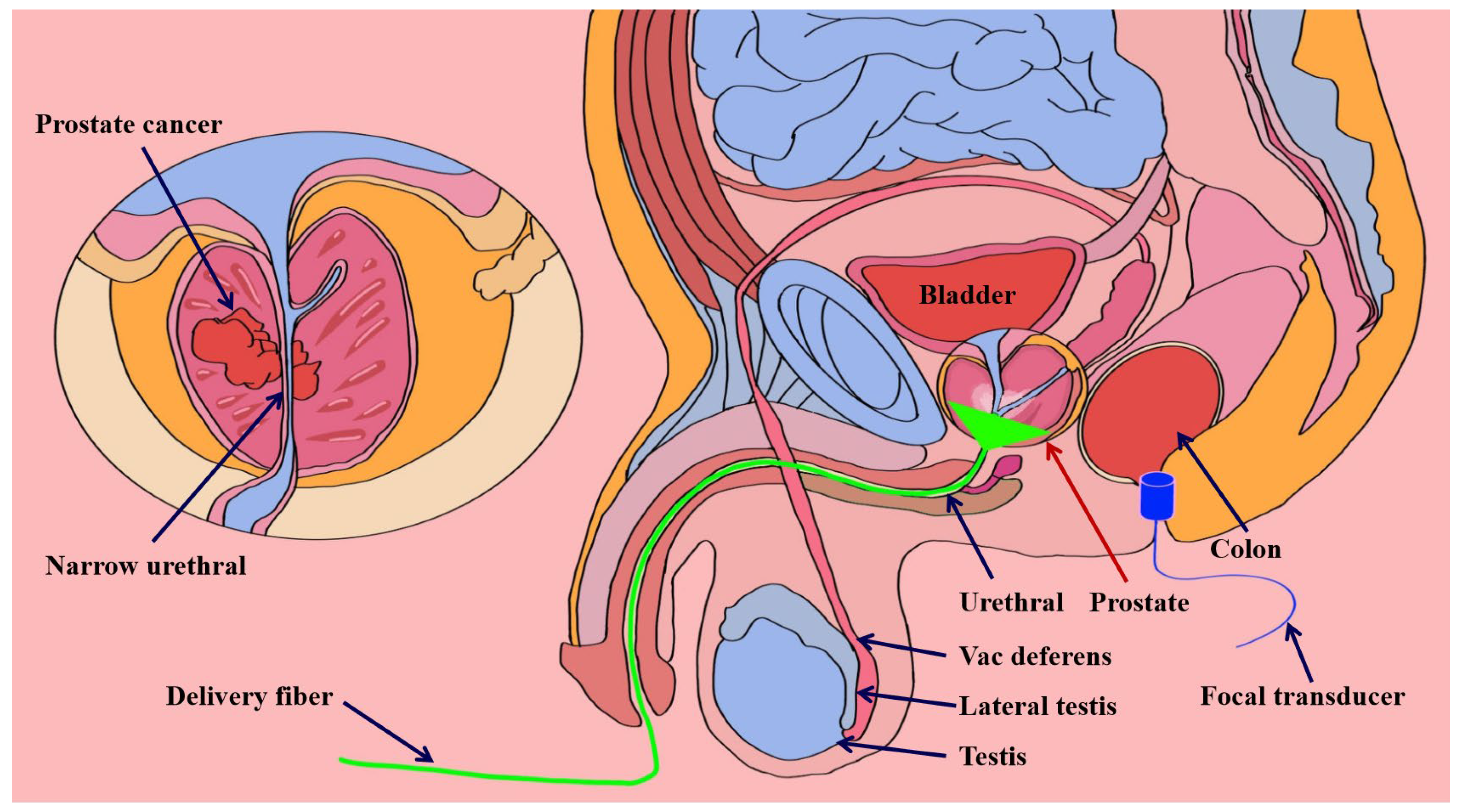 Photonics 11 00872 g002