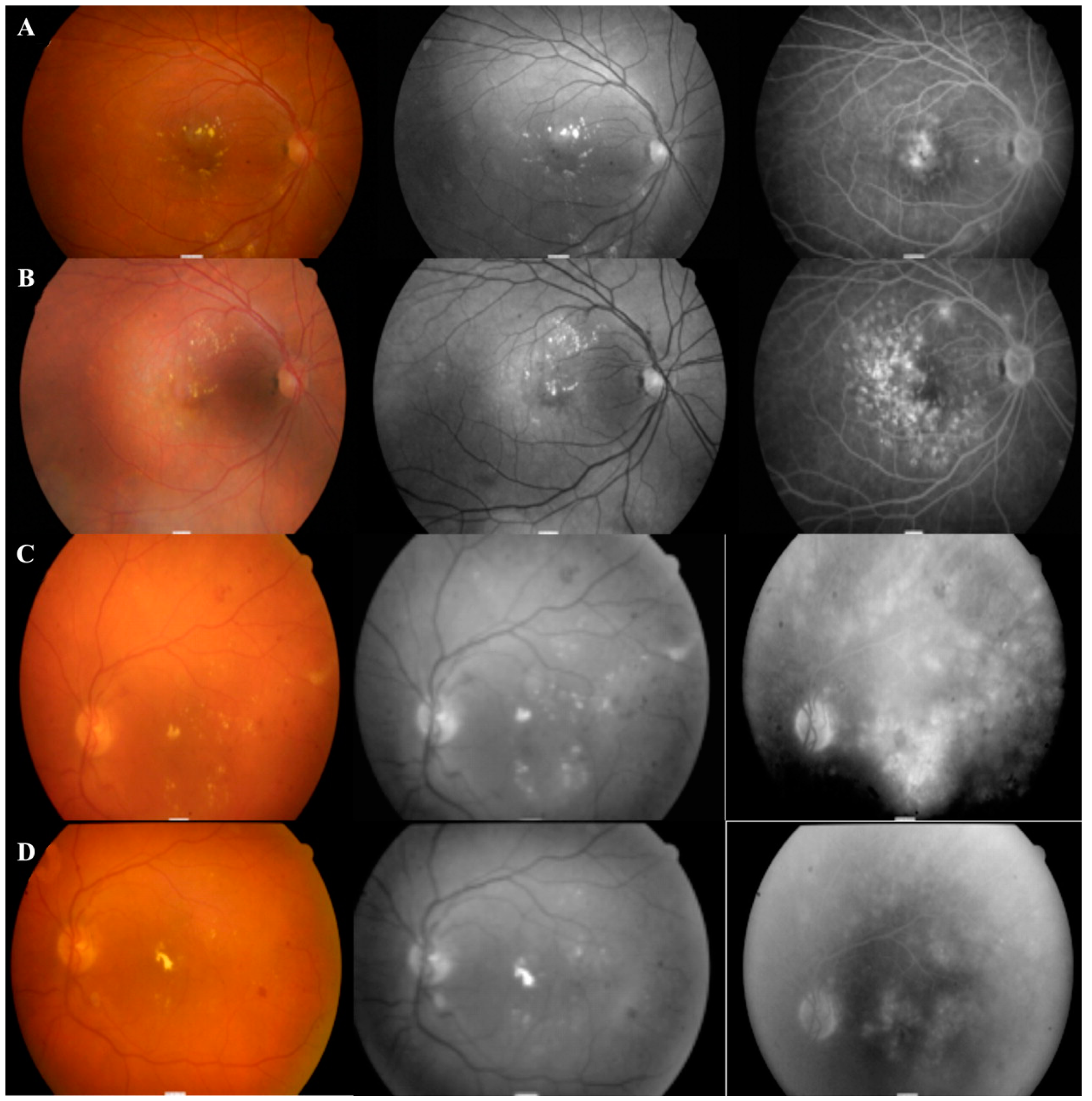 Photonics 12 00156 g002 Photonics 12 00156 g002