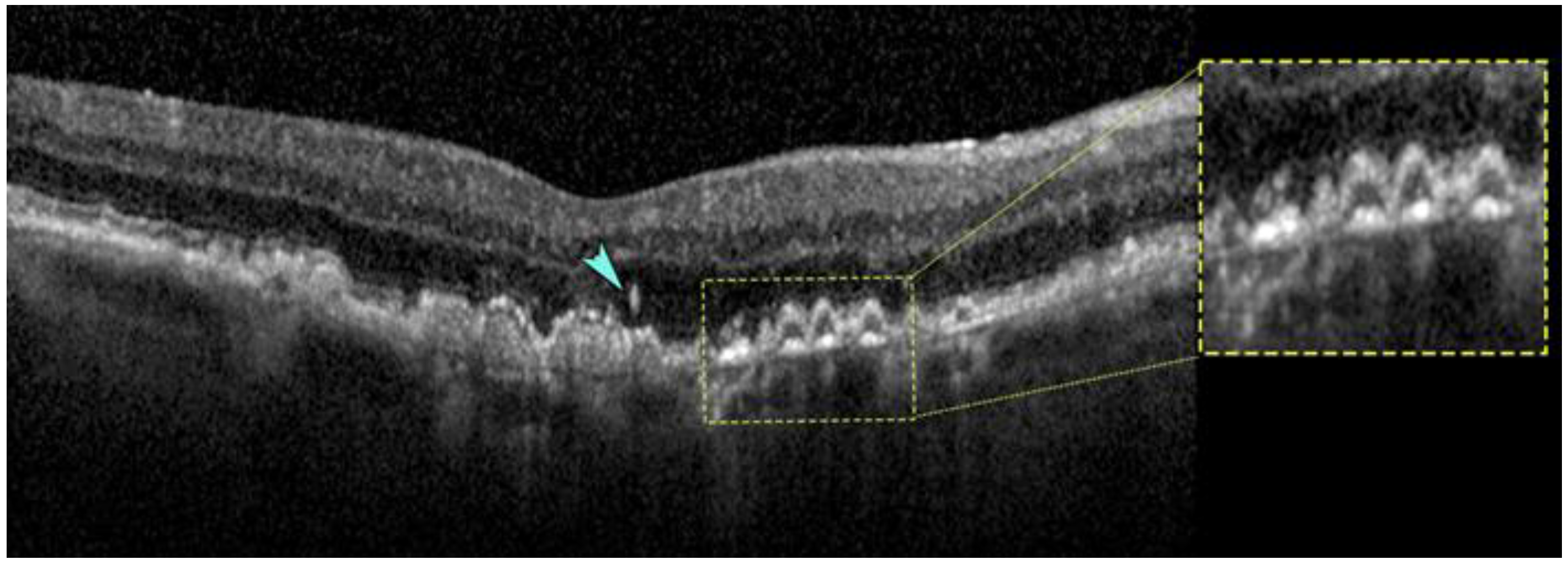 Photonics 12 00237 g001