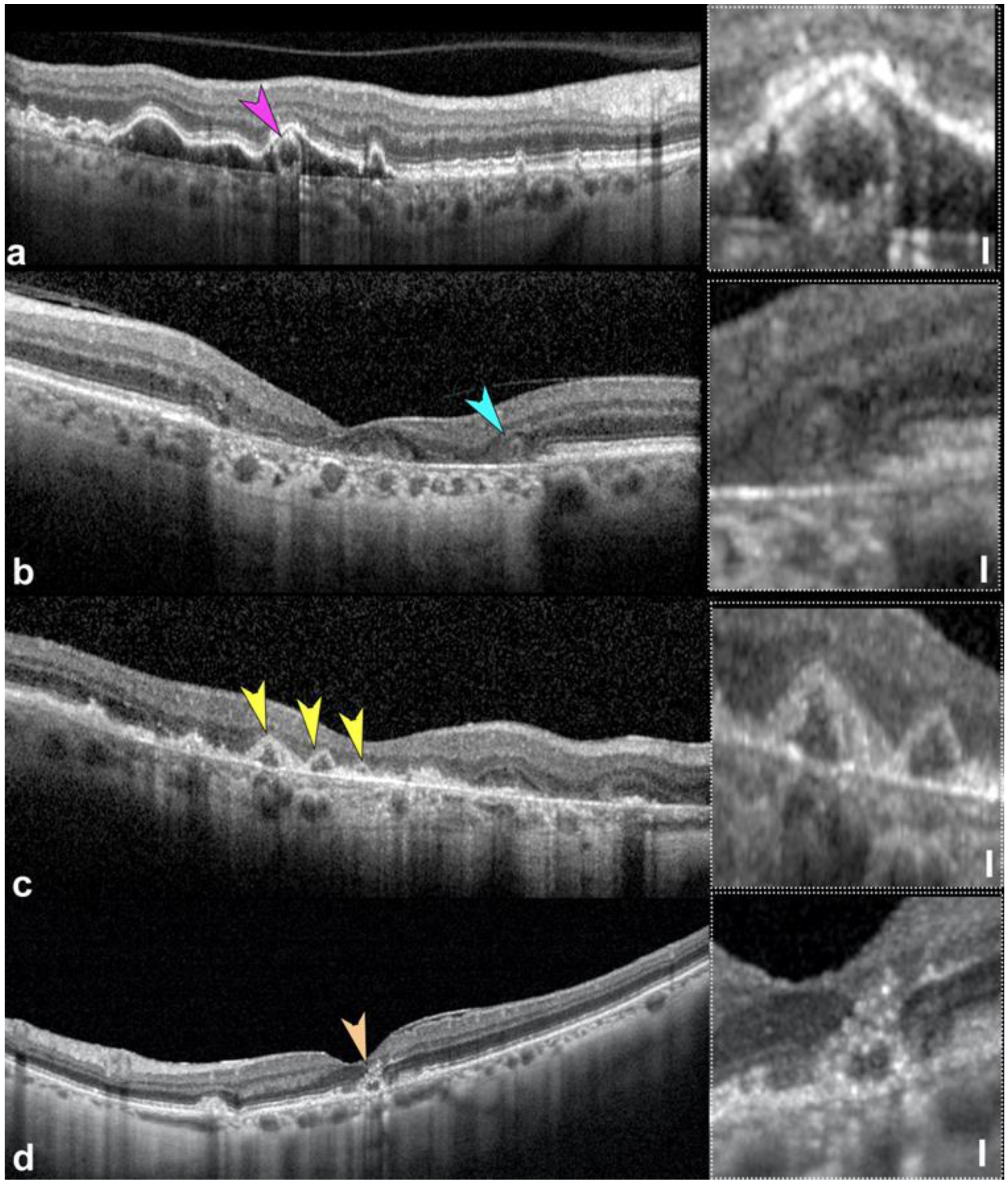 Photonics 12 00237 g002