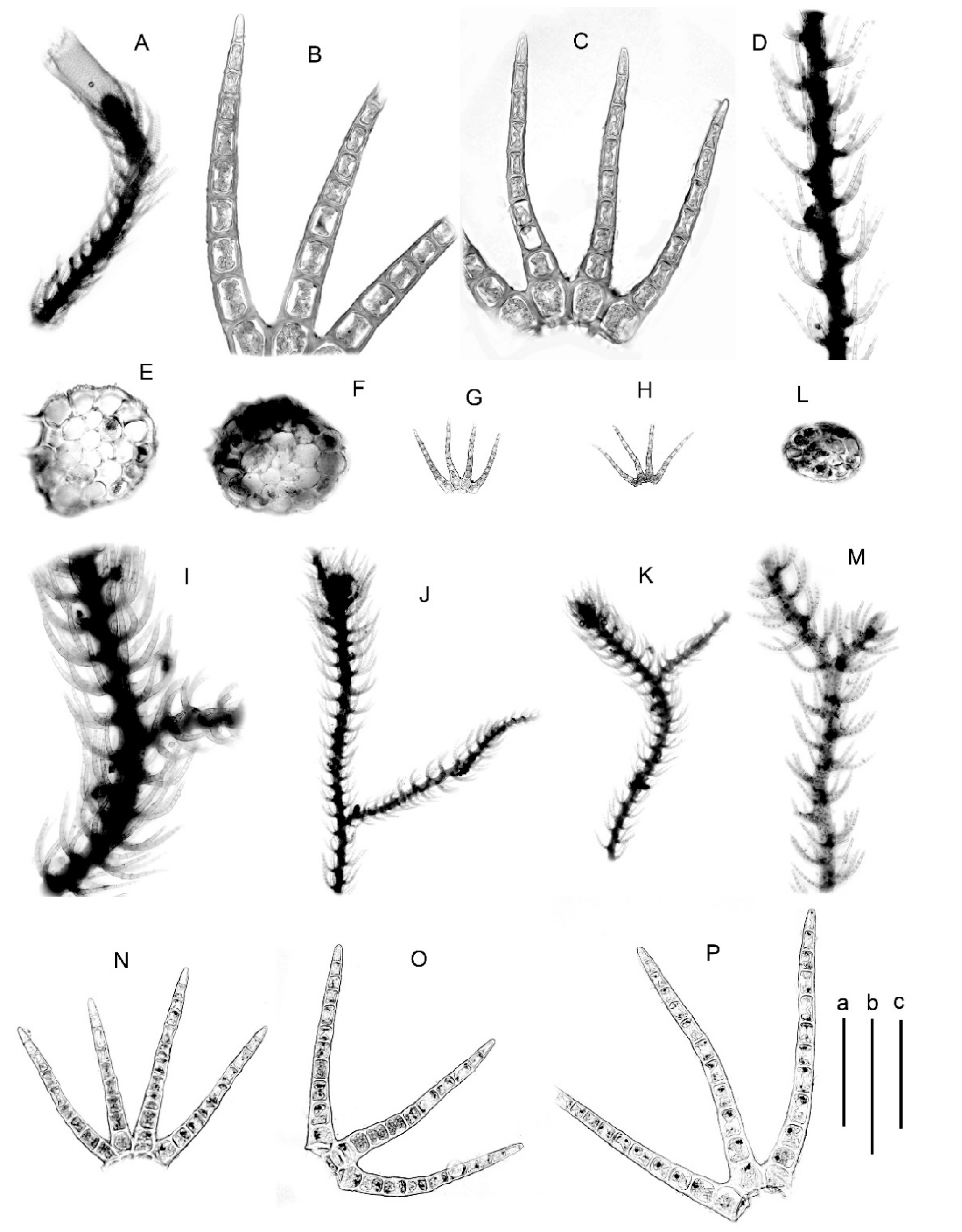 Plants Free Full Text Blepharostoma Trichophyllum S L Marchantiophyta The Complex Of Sibling Species And Hybrids Html