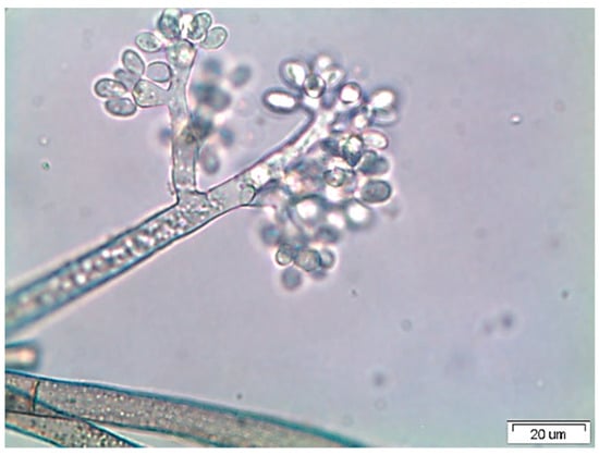 Strawberry Mold (Botrytis Cinerea): It is totally gross and we hate it. –  Toad Hall Gardens