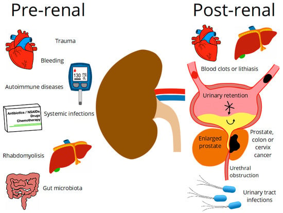 Plants Free Full Text Nephroprotective Plants A Review On The Use In Pre Renal And Post