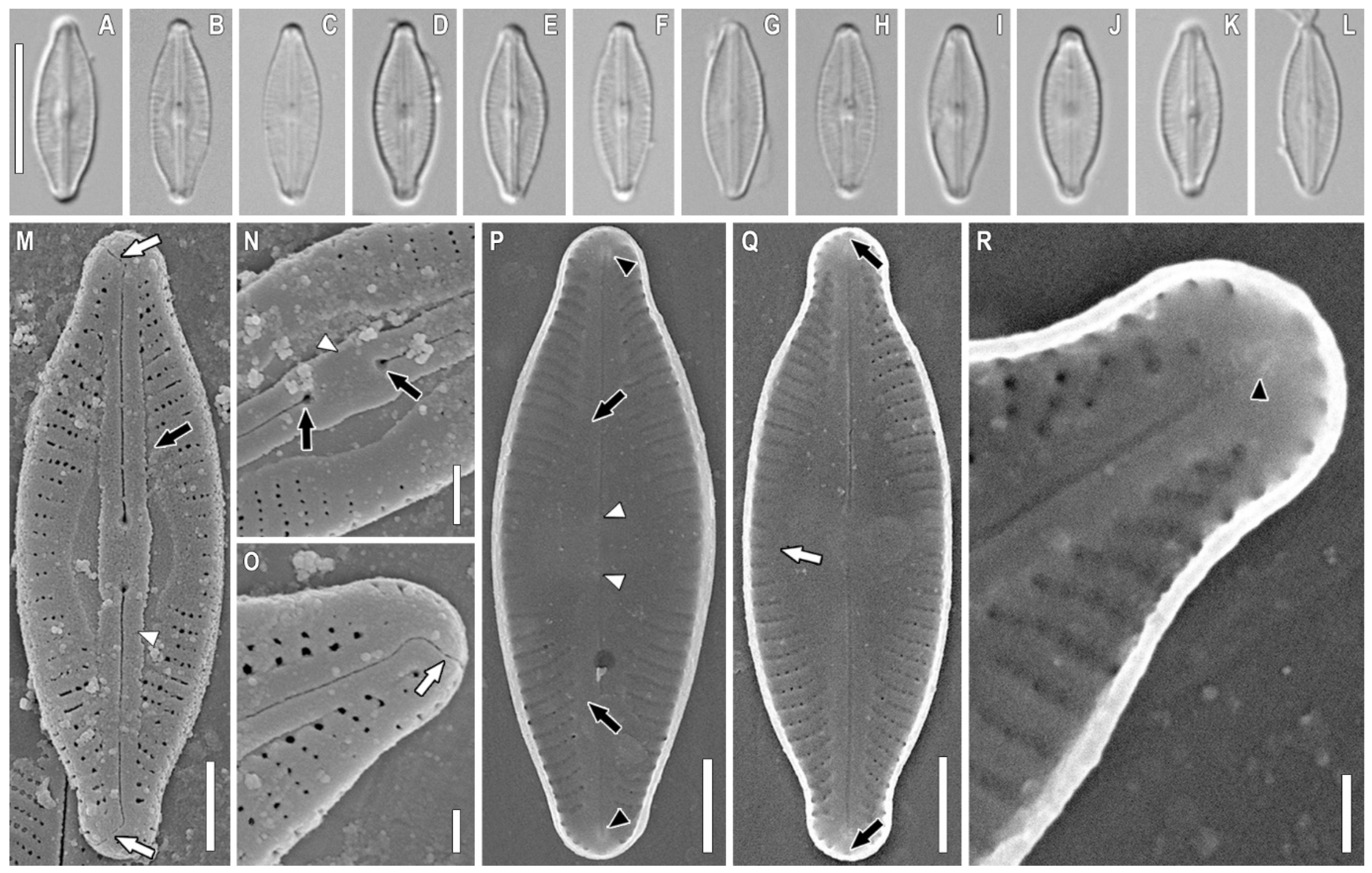 Plants | Free Full-Text | Description of the Soil Diatom Sellaphora  terrestris sp. nov. (Bacillariophyceae, Sellaphoraceae) from Vietnam, with  Remarks on the Phylogeny and Taxonomy of Sellaphora and Systematic Position  of Microcostatus