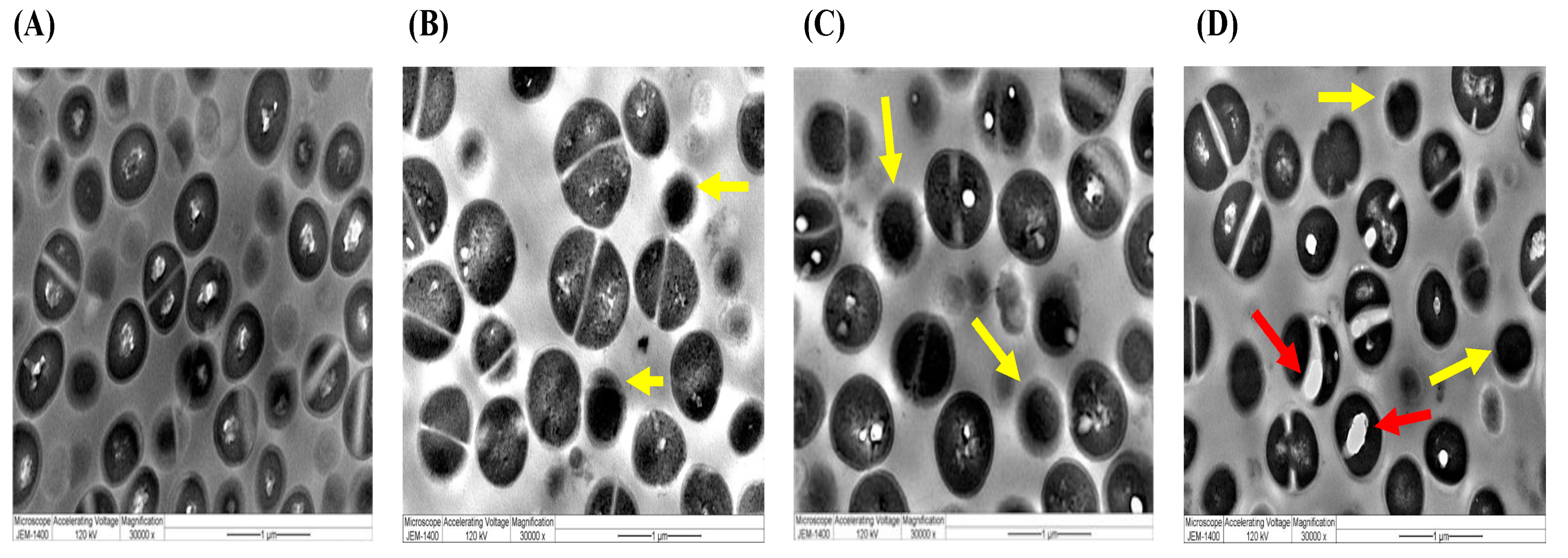 Plants 12 02093 g011