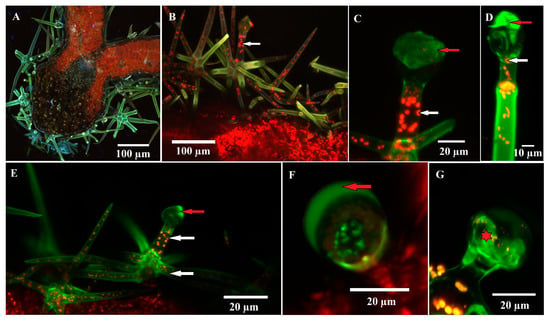 Salvia divinorum non-glandular trichomes (light microscopy). a