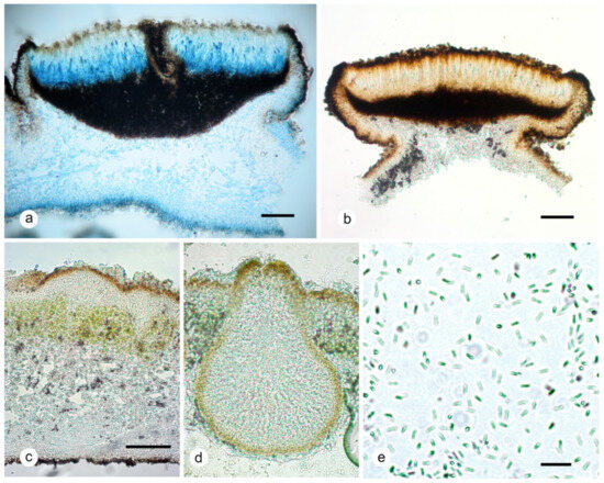 Multilocus Molecular Phylogeny of the Umbilicaria aprina Group  