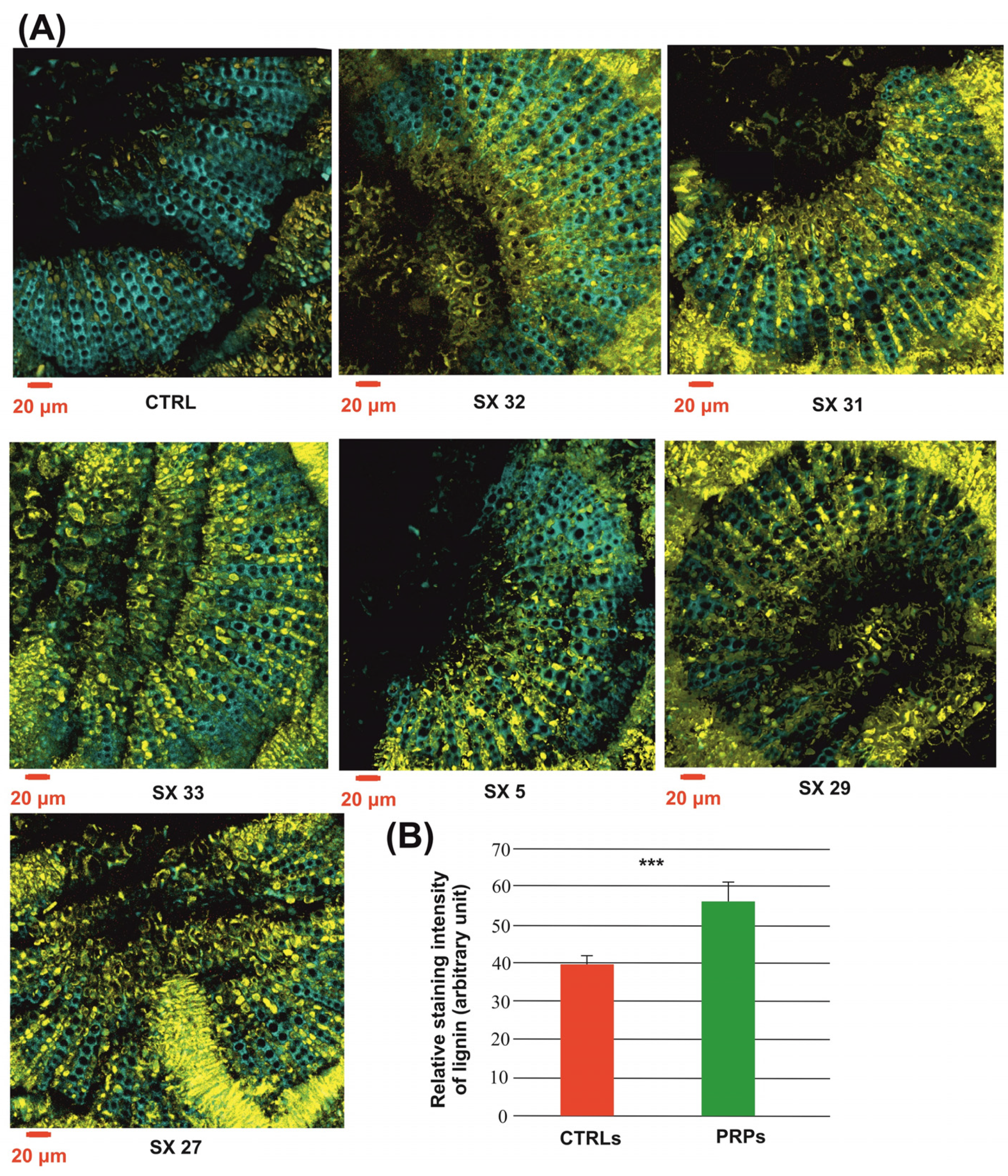 Plants 13 00930 g005