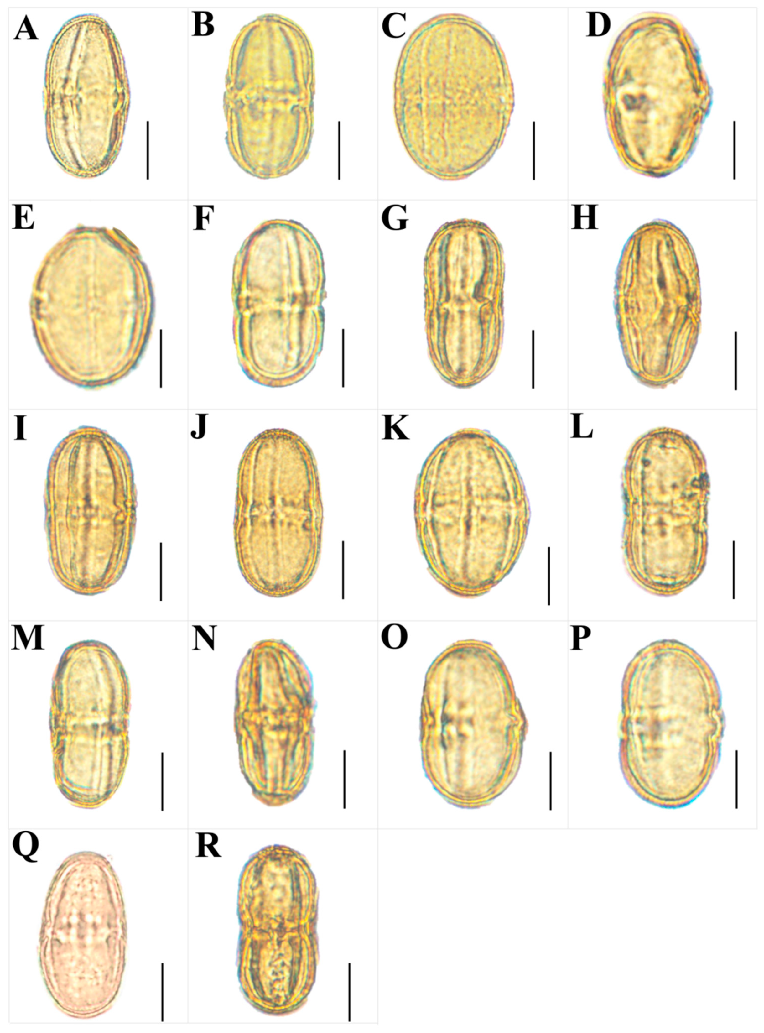Plants 13 01635 g011