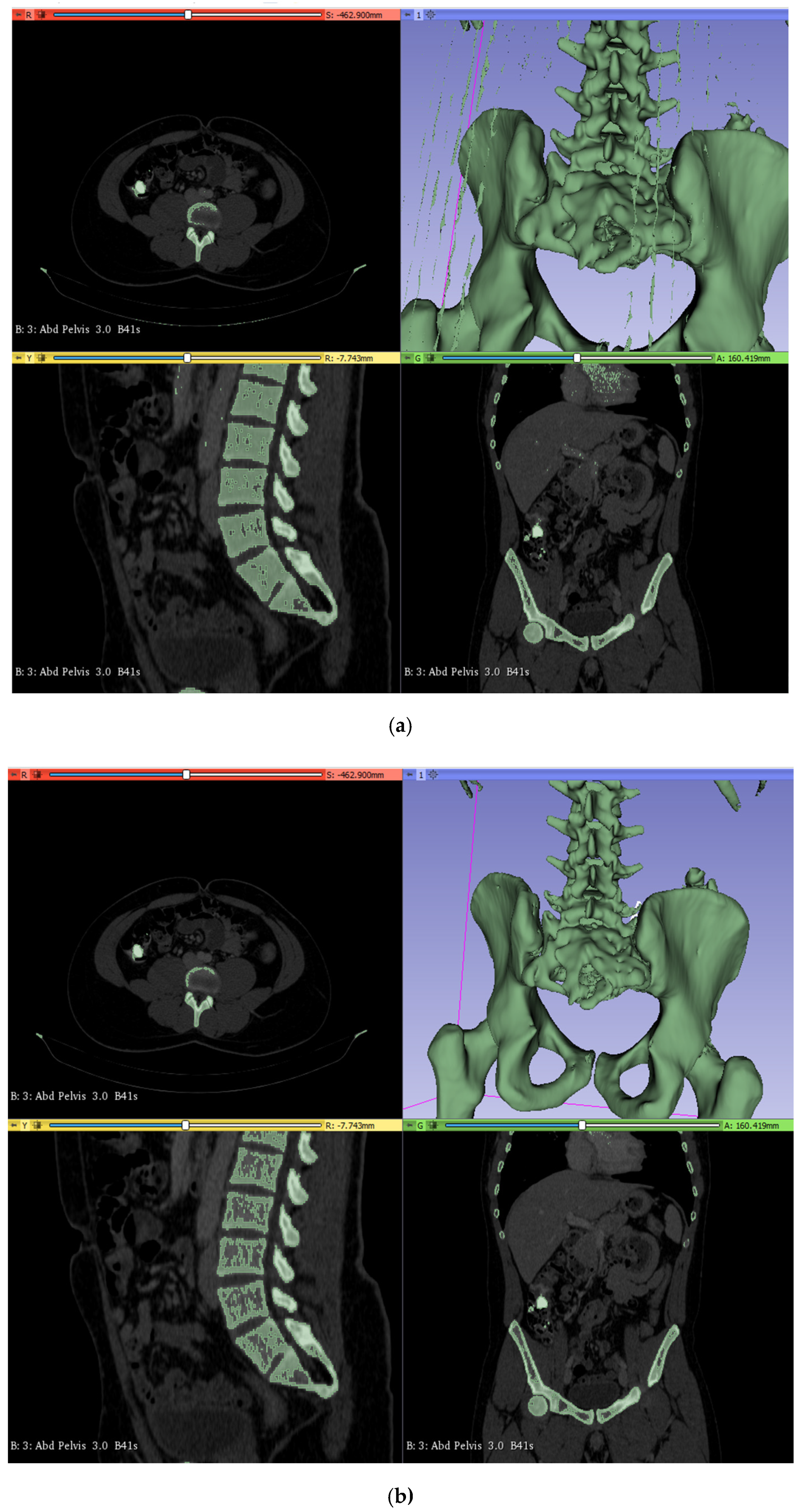 Pelvic Sacral Block  Medline Industries, Inc.