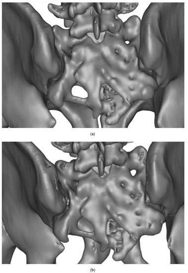 Pelvic Sacral Block  Medline Industries, Inc.