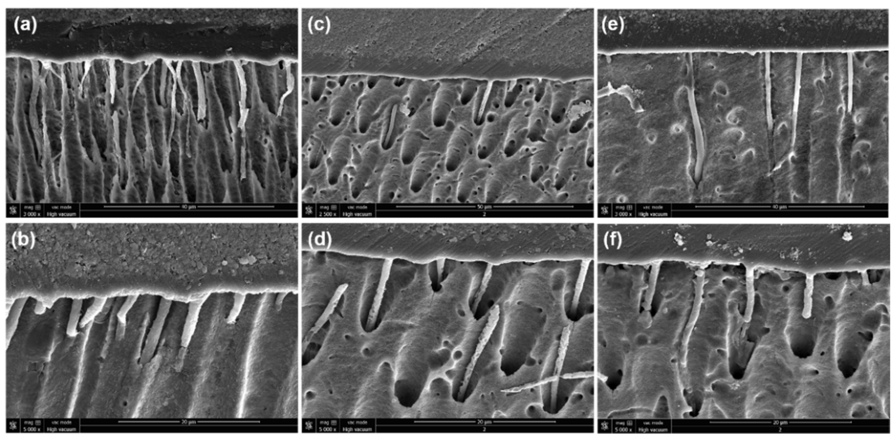 Polymers Free Full Text Antibacterial And Bonding Properties Of Universal Adhesive Dental Polymers Doped With Pyrogallol Html