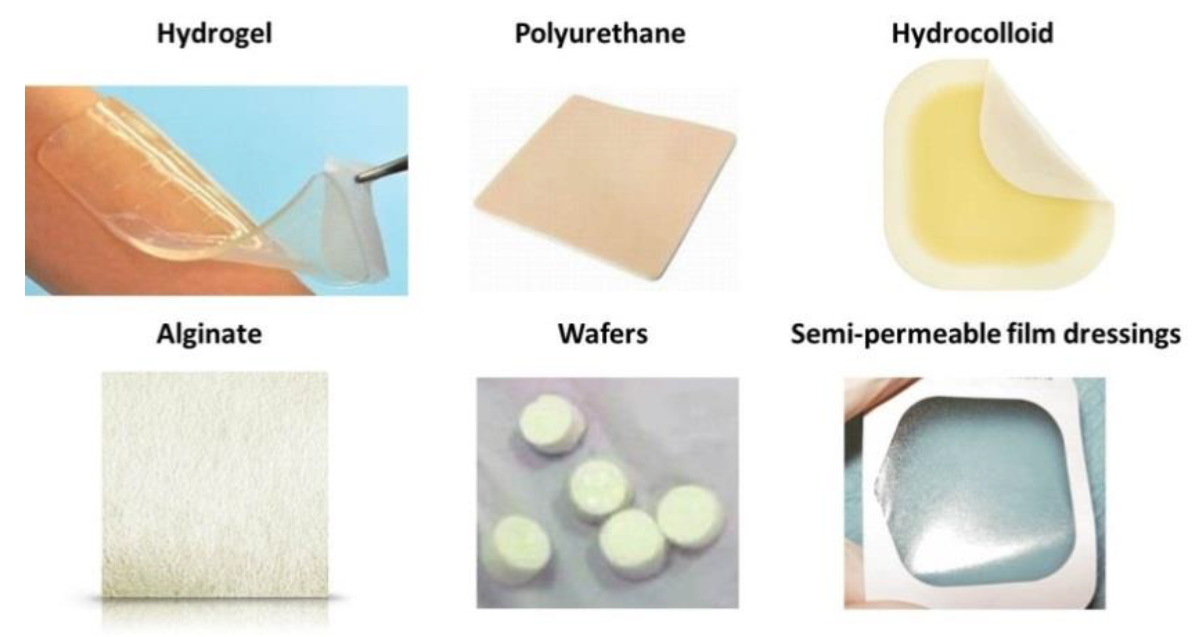 Polymers | Free Full-Text | Polymer-Based Wound Dressing Materials Loaded  with Bioactive Agents: Potential Materials for the Treatment of Diabetic  Wounds