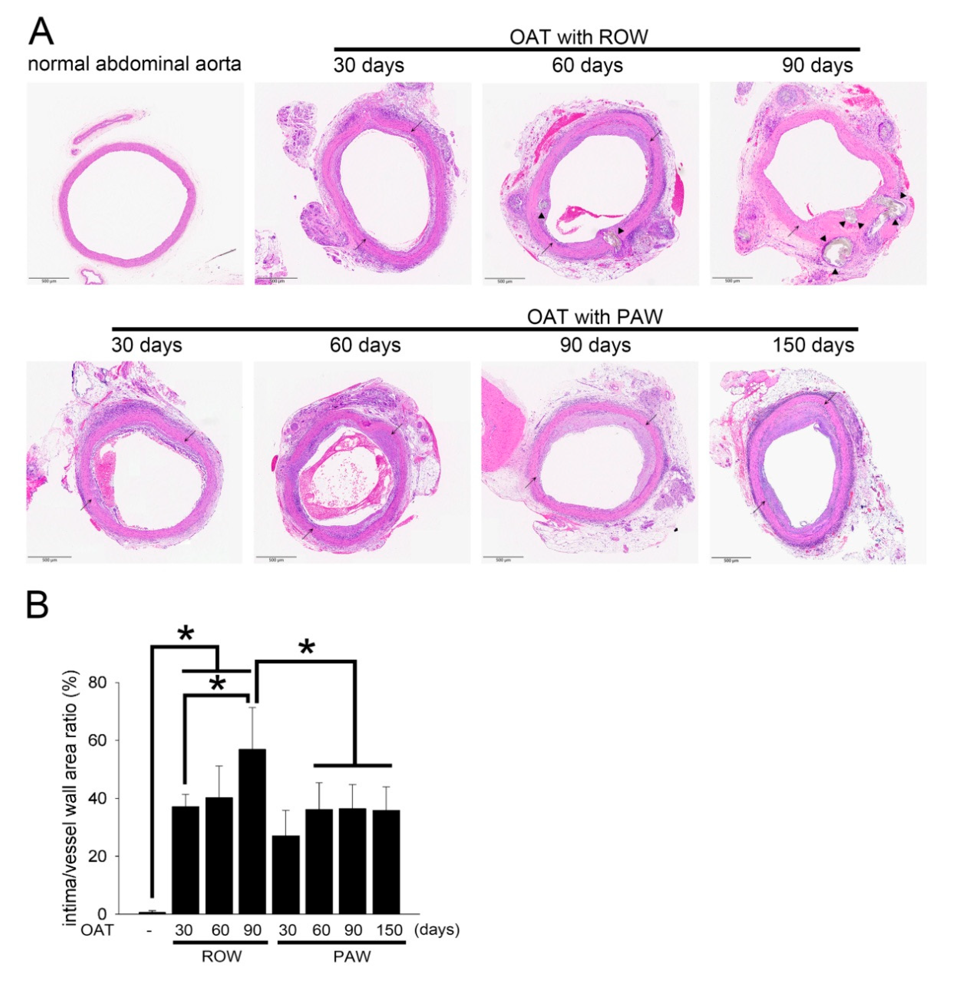 Polymers Free Full Text Transferring Plasmon Effect On A Biological System Expression Of Biological Polymers In Chronic Rejection And Inflammatory Rat Model Html