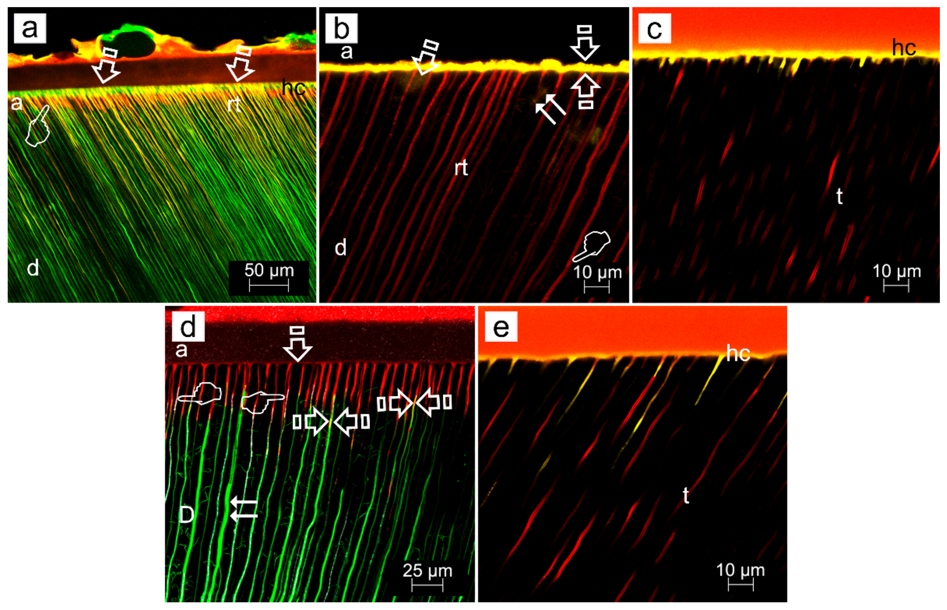 Polymers 14 00642 g006