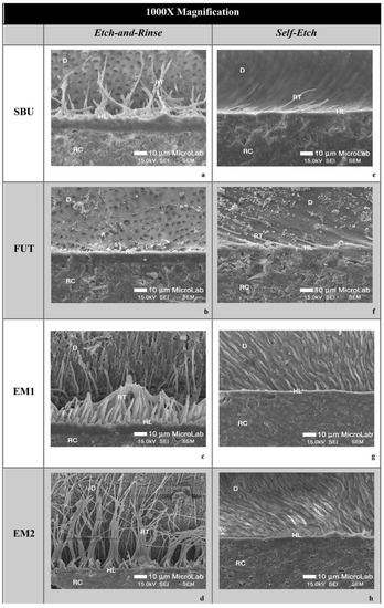 Design of EBrH‐GEL detachable universal adhesive and its