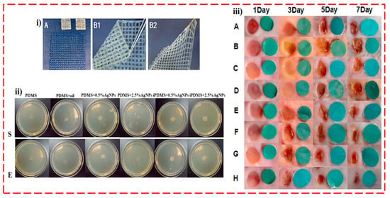 Polymers | Free Full-Text | A Review On Antibacterial Biomaterials In ...