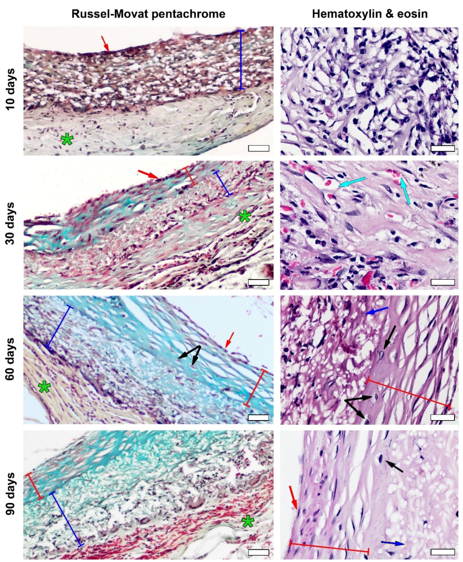 Polymers 14 03313 g005