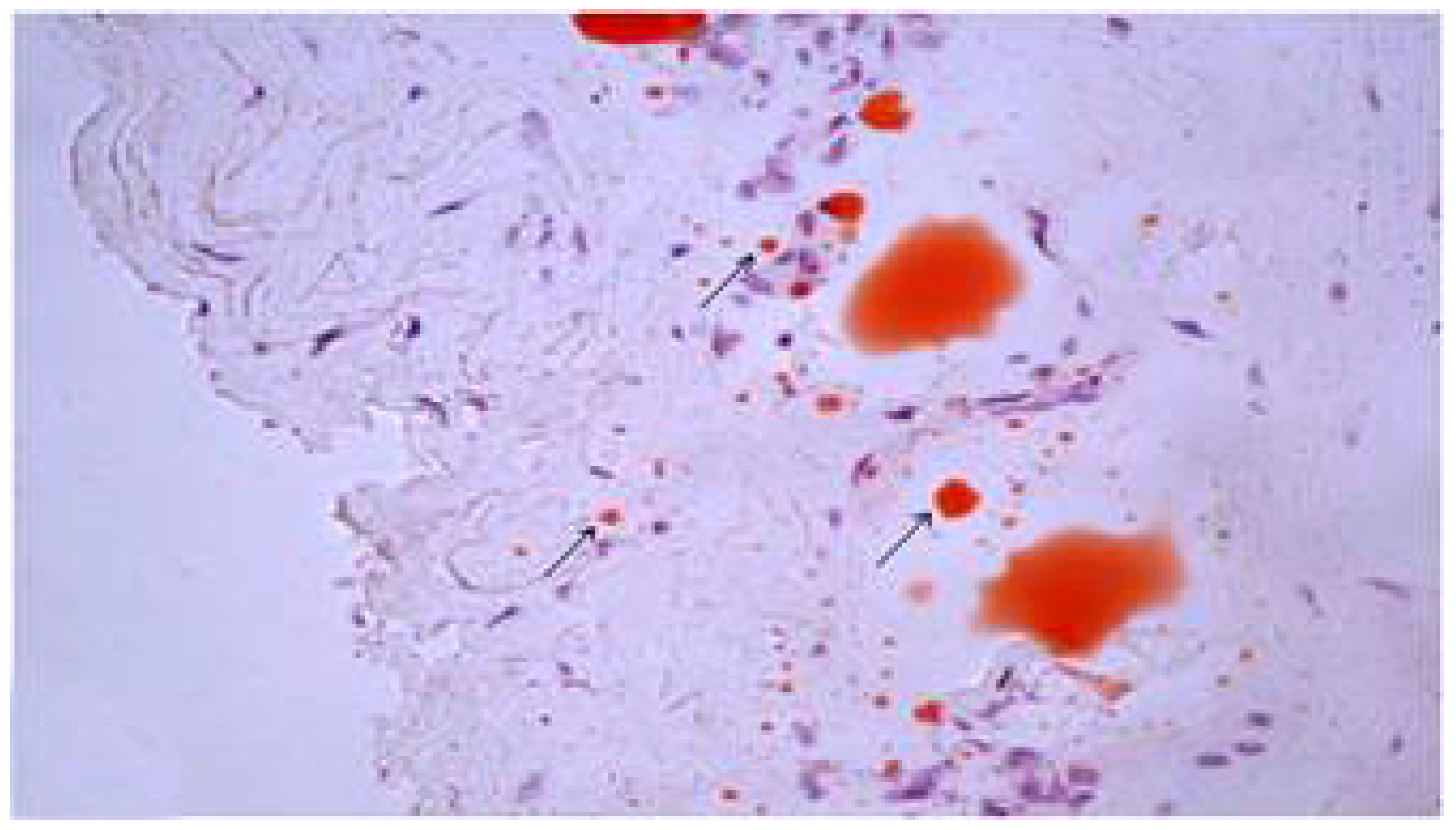 Polymers 14 03431 g004