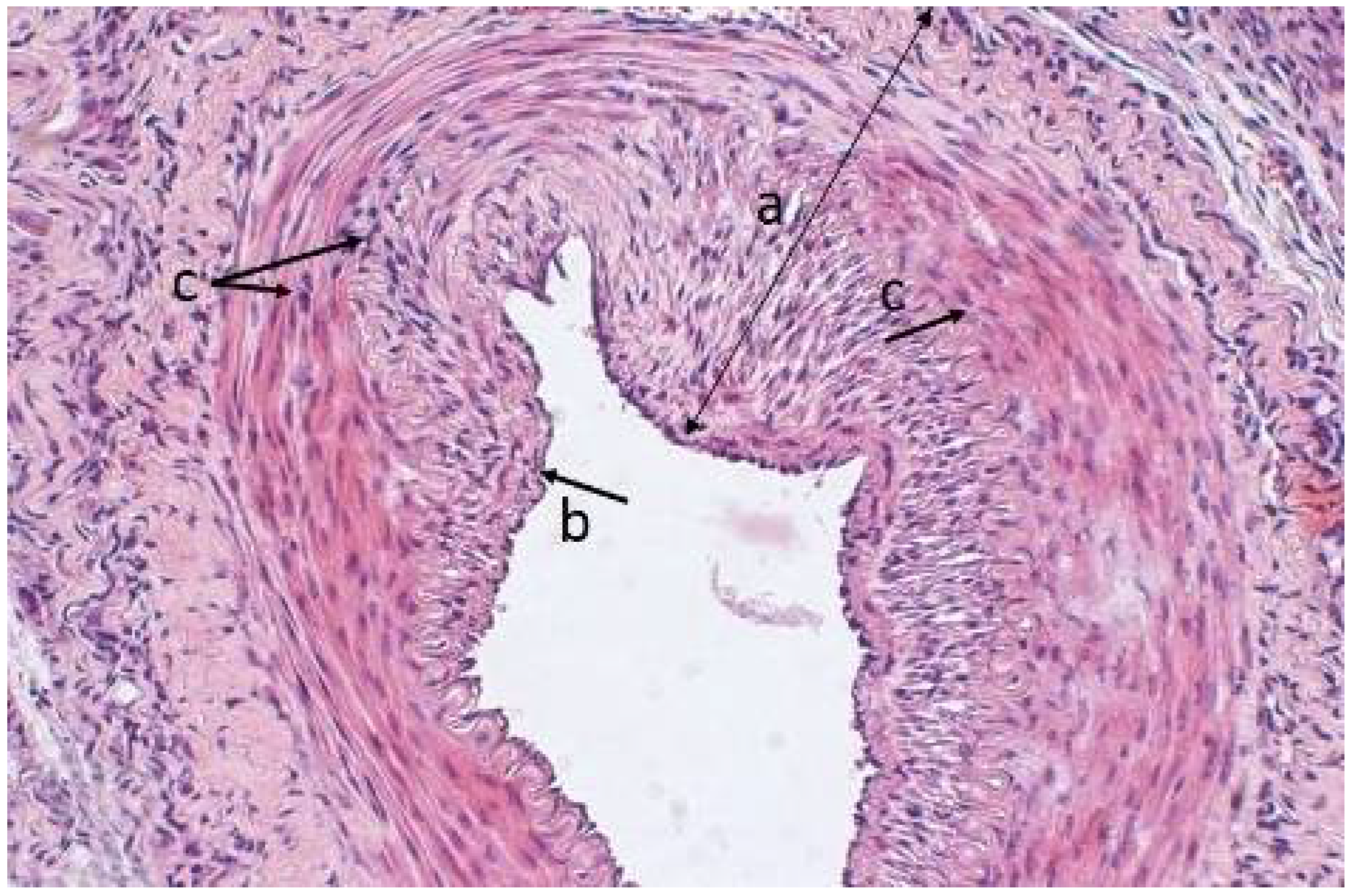 Polymers 14 03431 g008