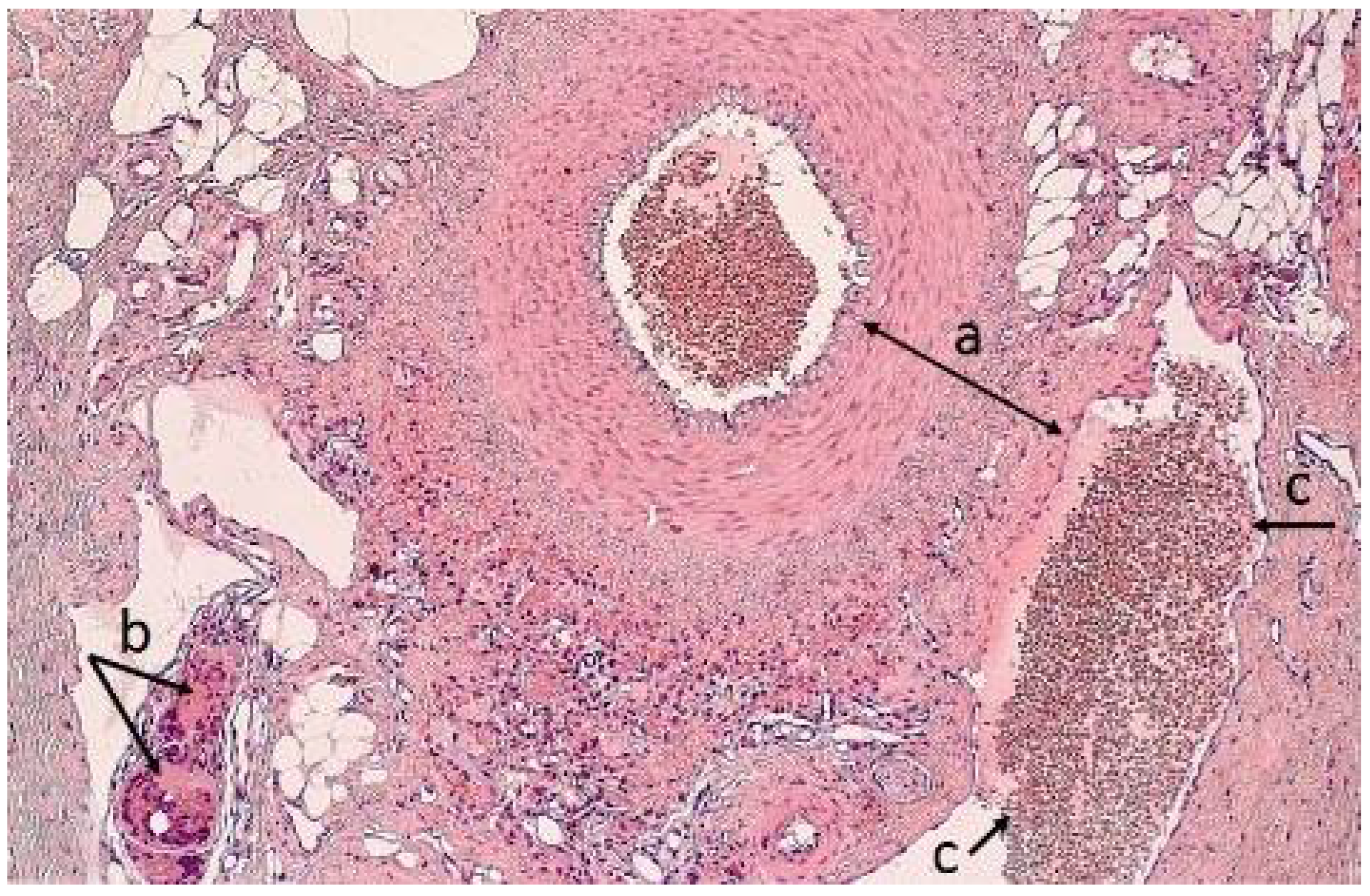 Polymers 14 03431 g009