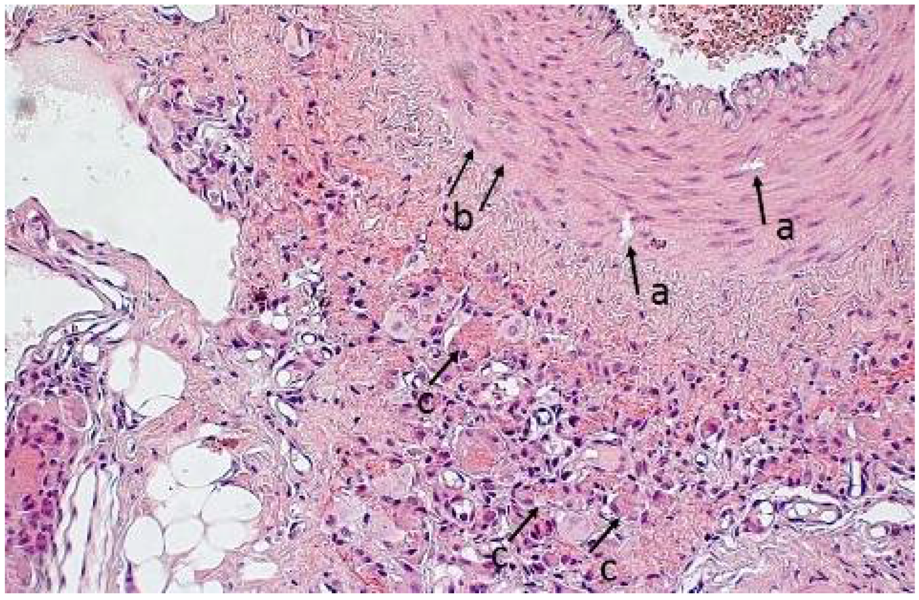 Polymers 14 03431 g010
