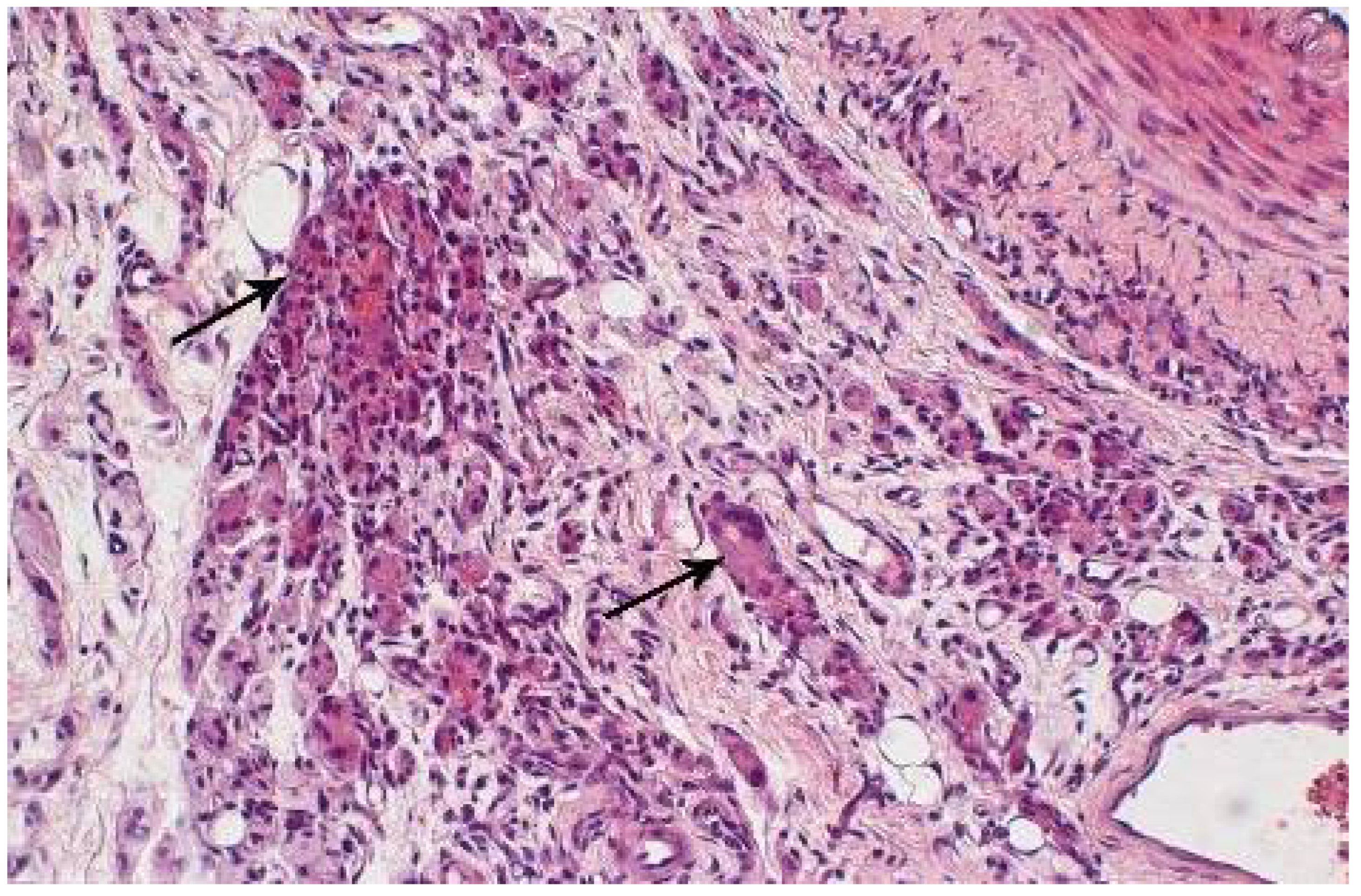 Polymers 14 03431 g011