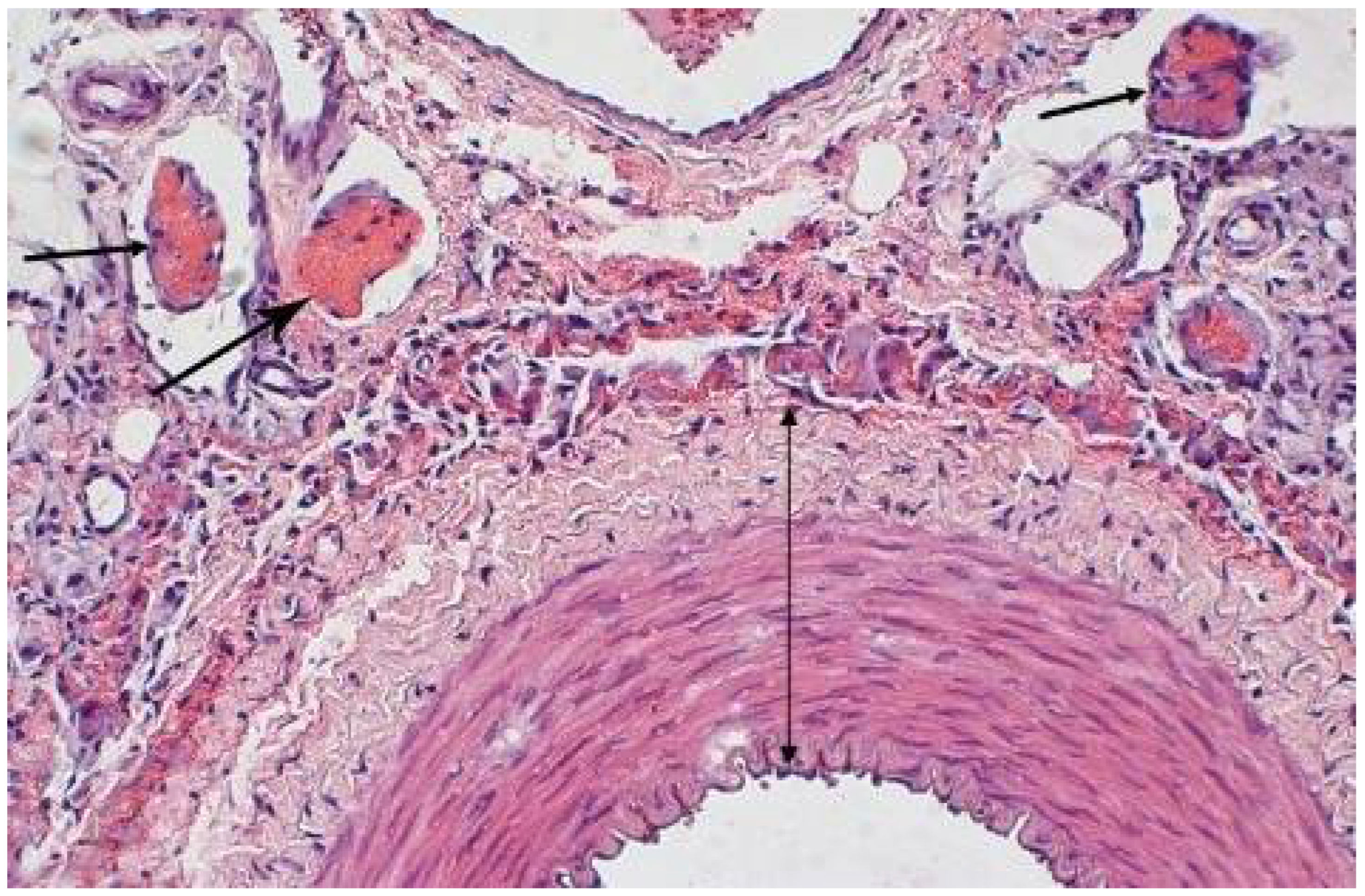 Polymers 14 03431 g013