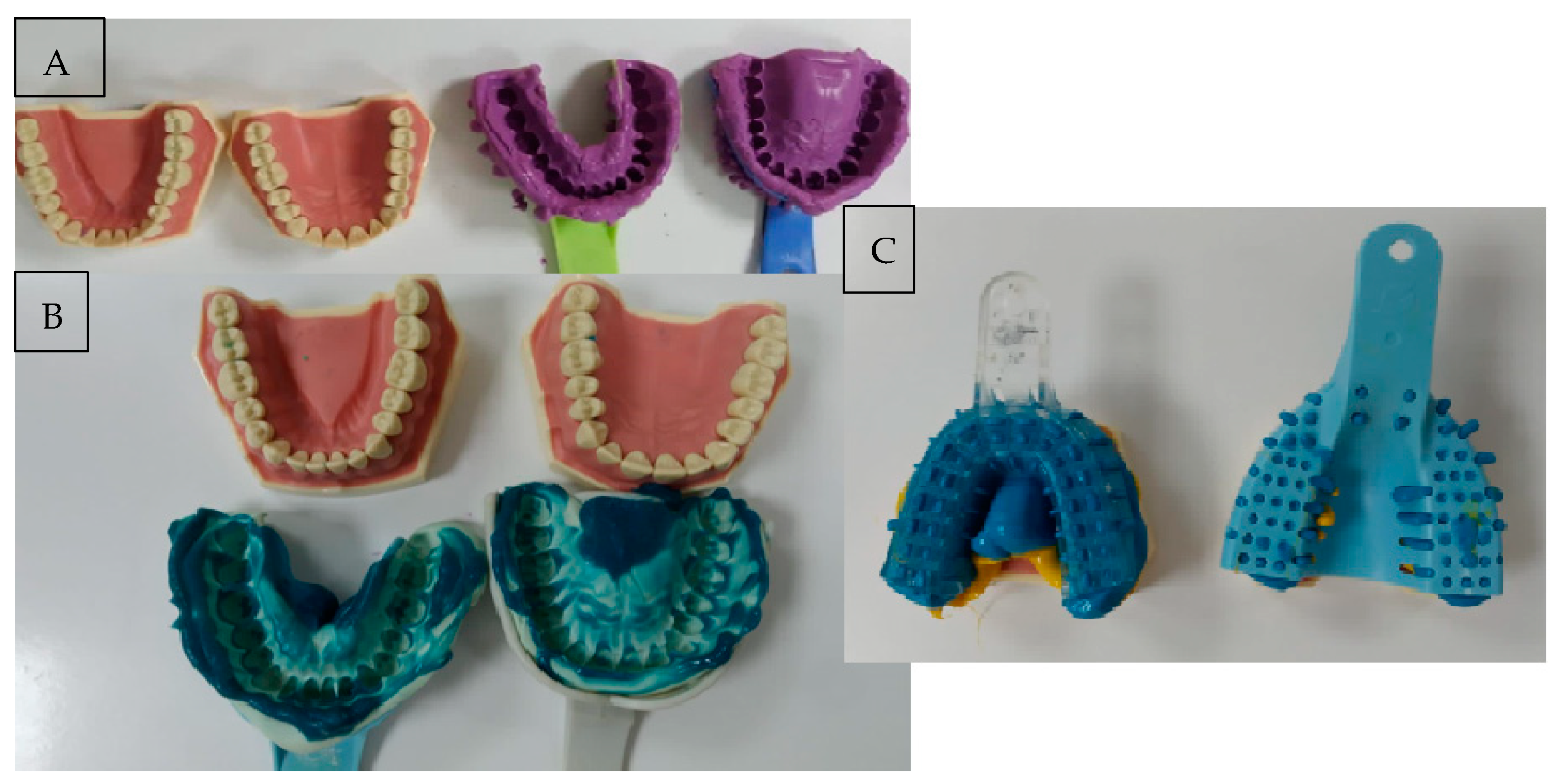 Impression Materials – Non-elastic – My Dental Technology Notes