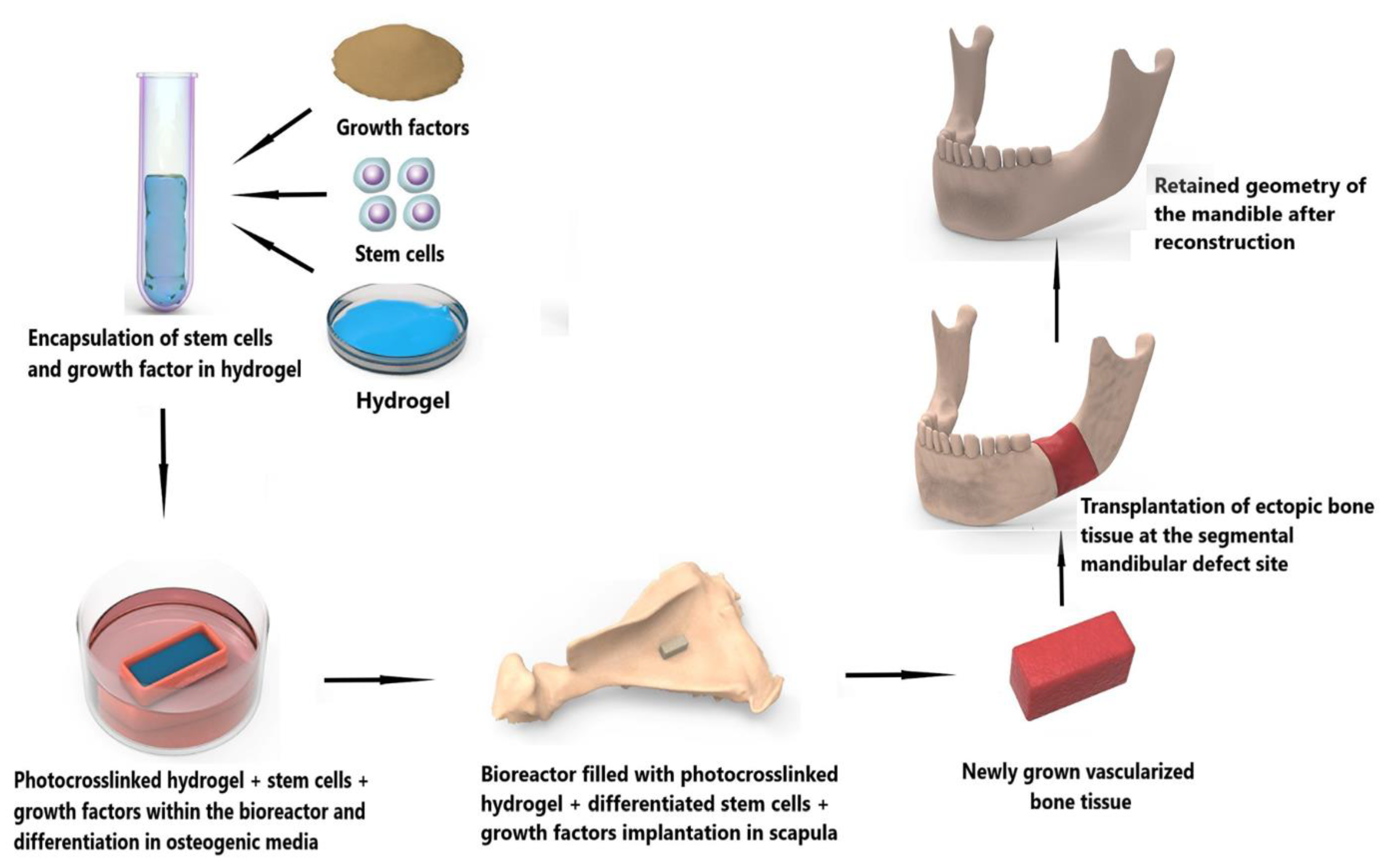 Polymers | Free Full-Text | Hydrogel: A Potential Material For Bone ...