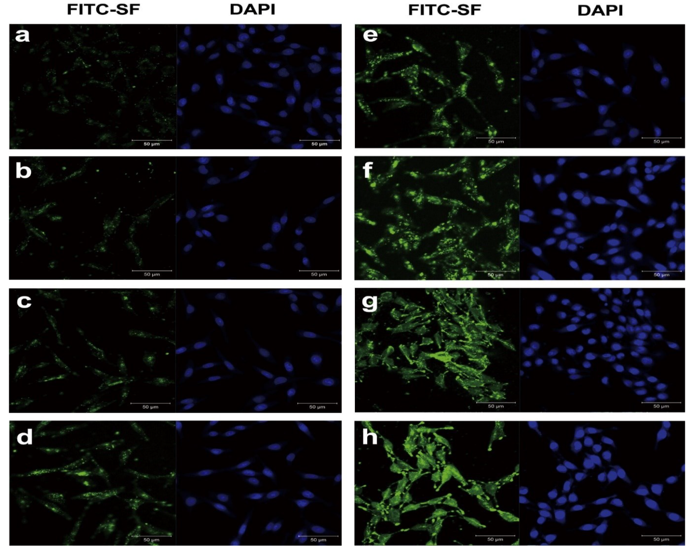 Polymers | Free Full-Text | Promising Role of Silk-Based Biomaterials ...