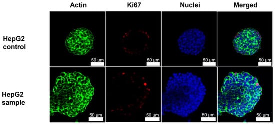 Polymers | Free Full-Text | Stiffness-Controlled Hydrogels for 3D Cell ...