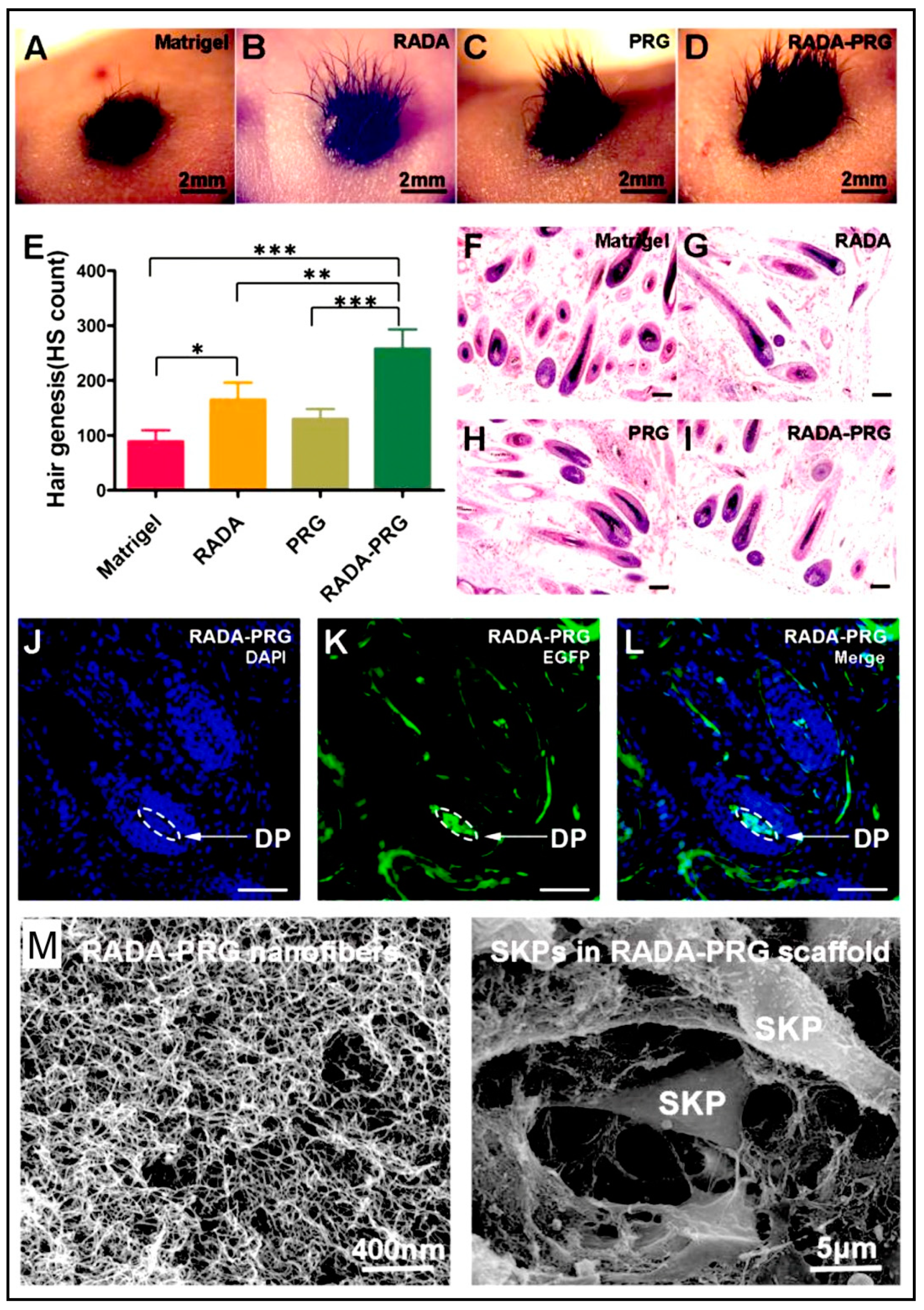 Polymers 15 01160 g012 Polymers 15 01160 g012