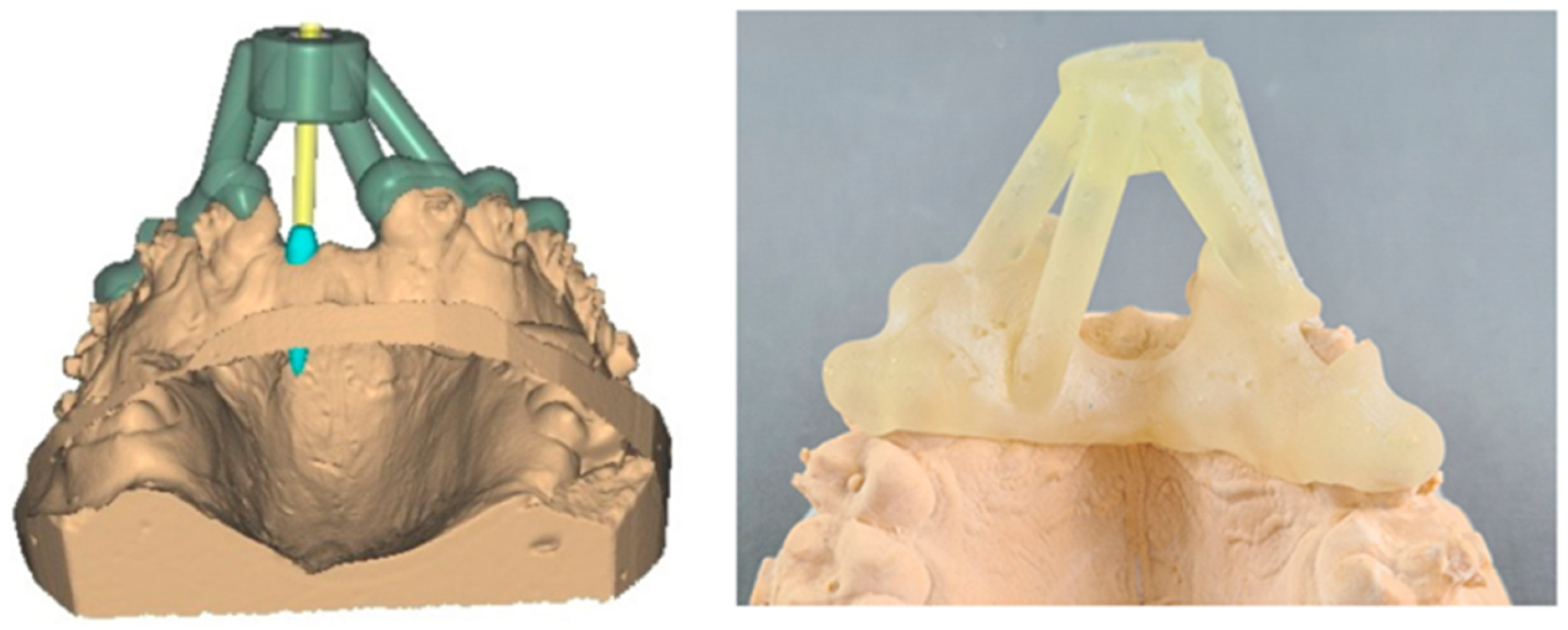 Polymers 15 02519 g009 Polymers 15 02519 g009
