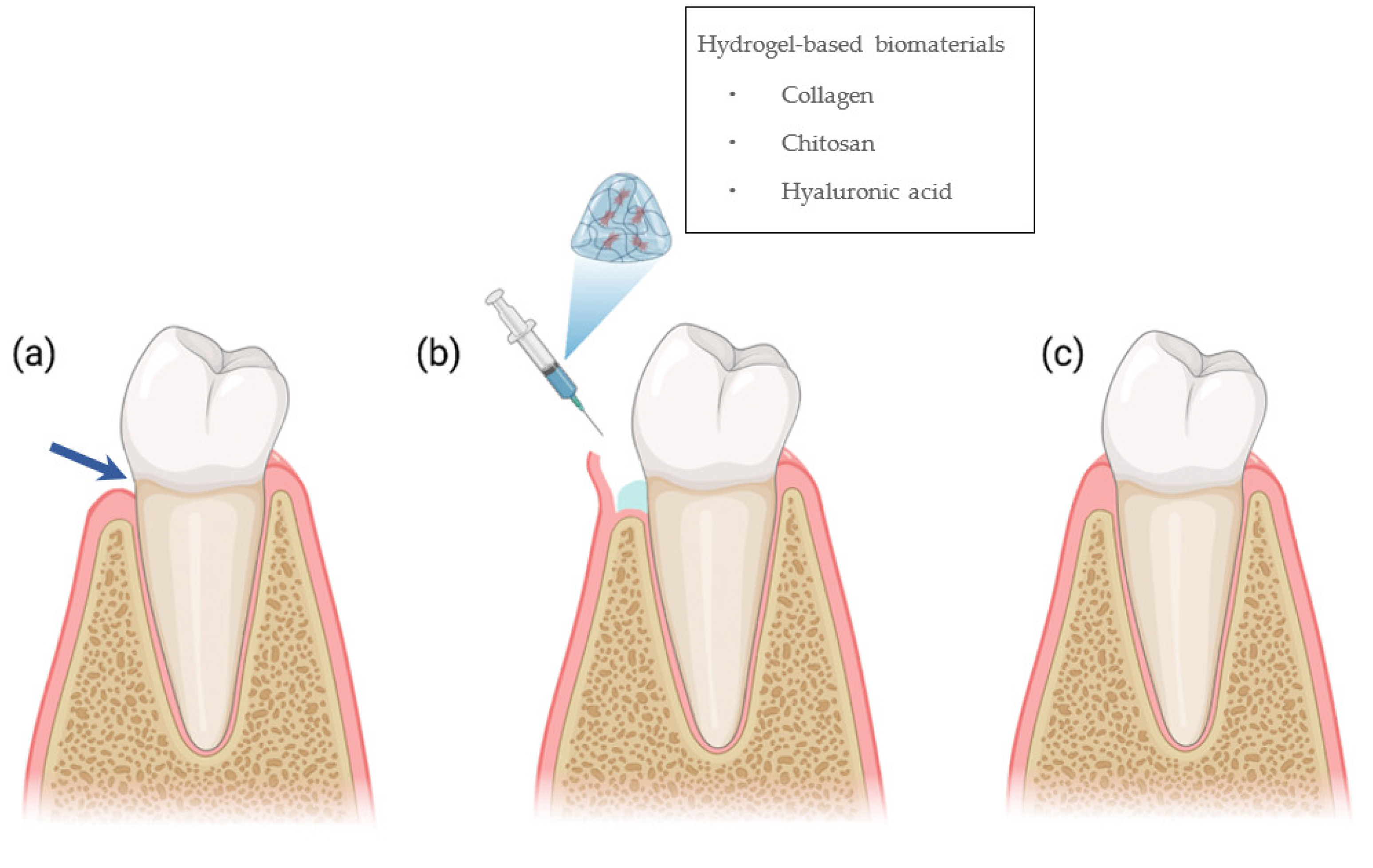 PVA-based hydrogels for tissue engineering: A review: International Journal  of Polymeric Materials and Polymeric Biomaterials: Vol 66, No 4