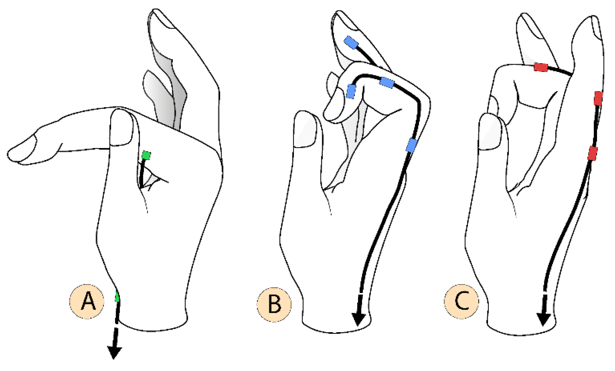 Proceedings | Free Full-Text | A Concept Design of an Adaptive Tendon ...