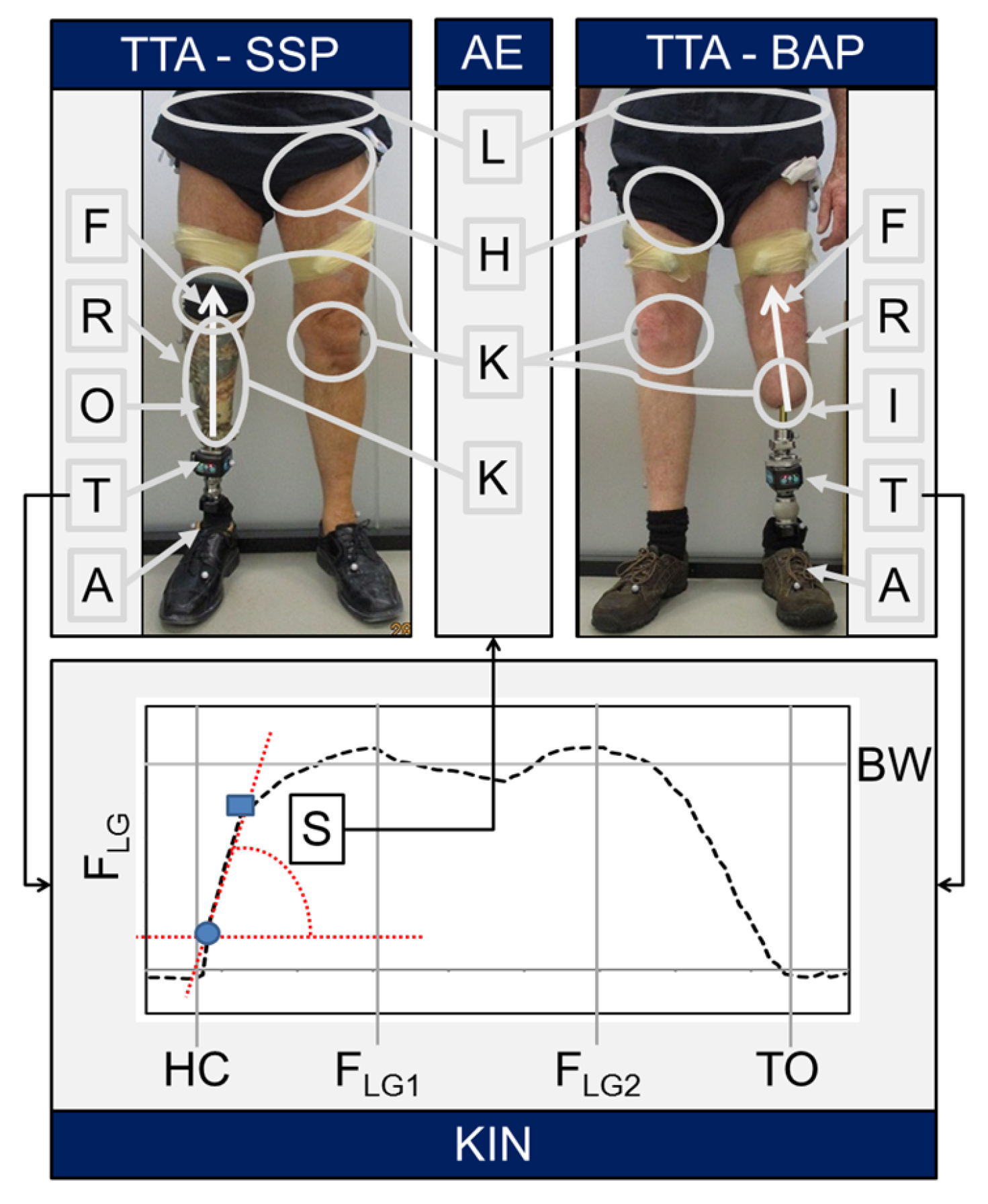 Prosthesis | Free Full-Text | Kinetics of Lower Limb Prosthesis: Automated  Detection of Vertical Loading Rate