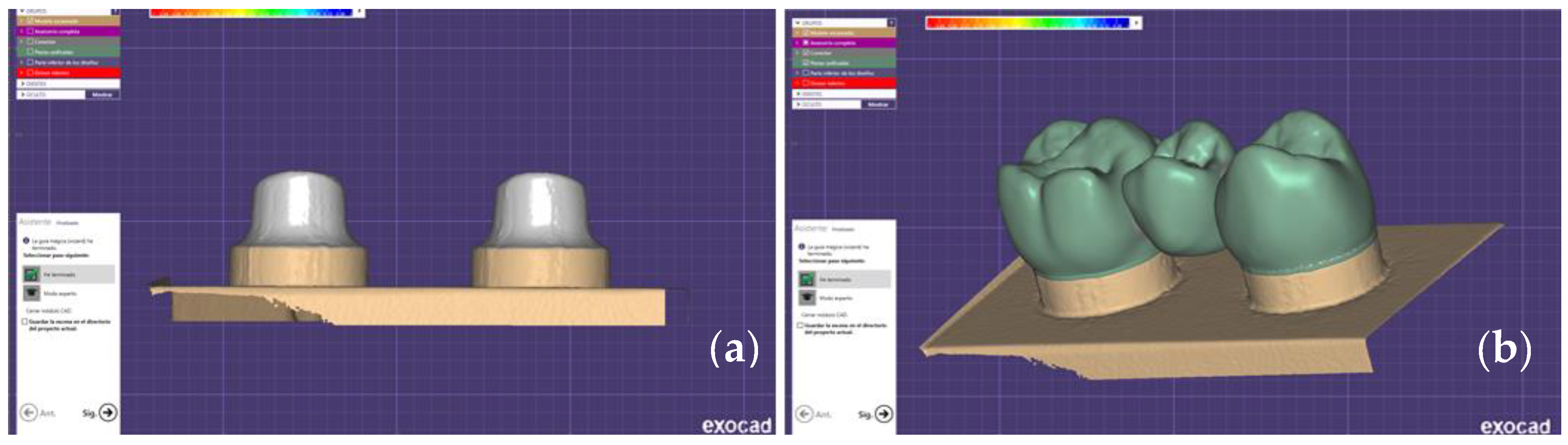 Prosthesis 02 00021 g001 Prosthesis 02 00021 g001