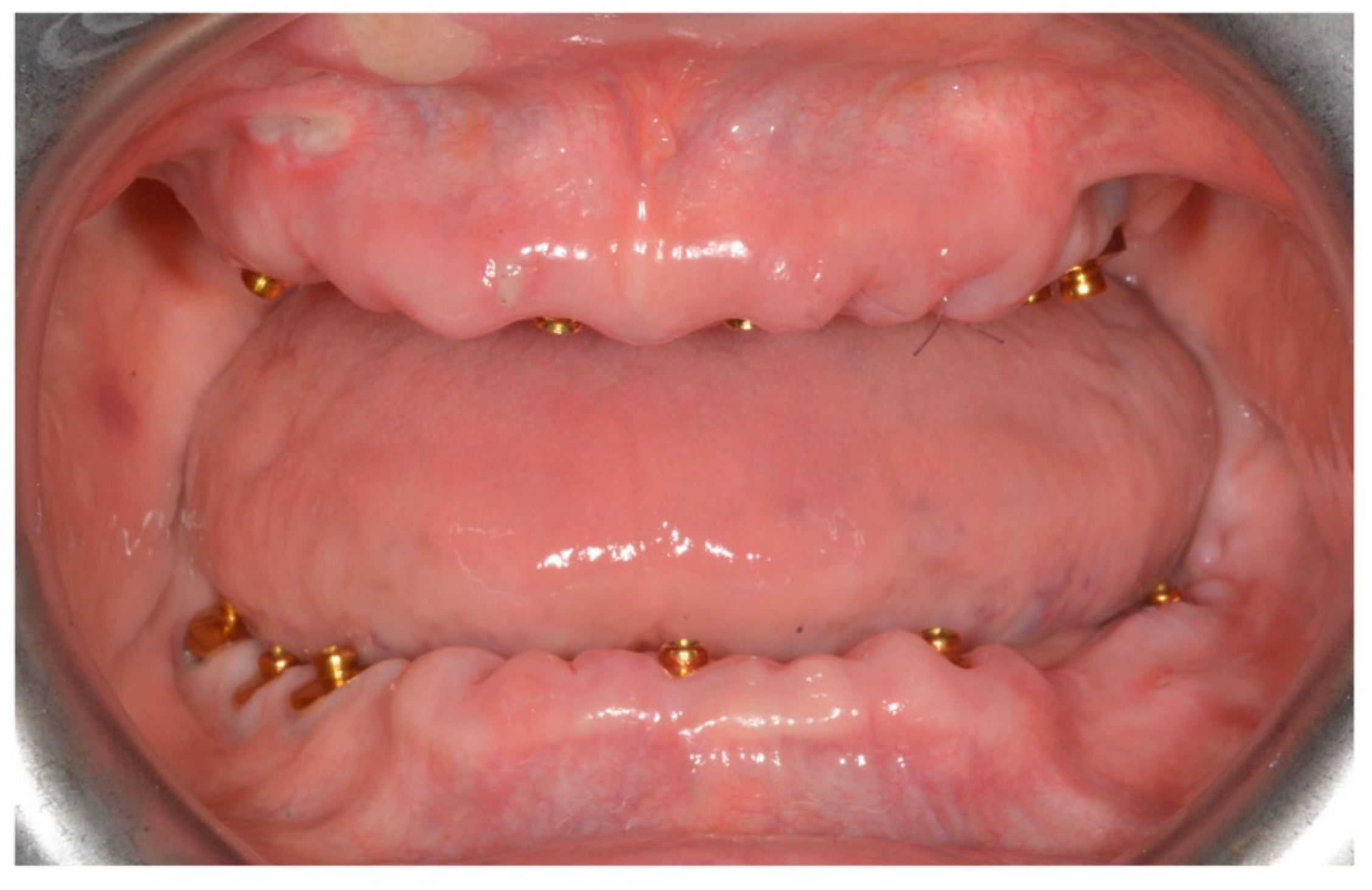 Prosthesis 02 00033 g001 Prosthesis 02 00033 g001