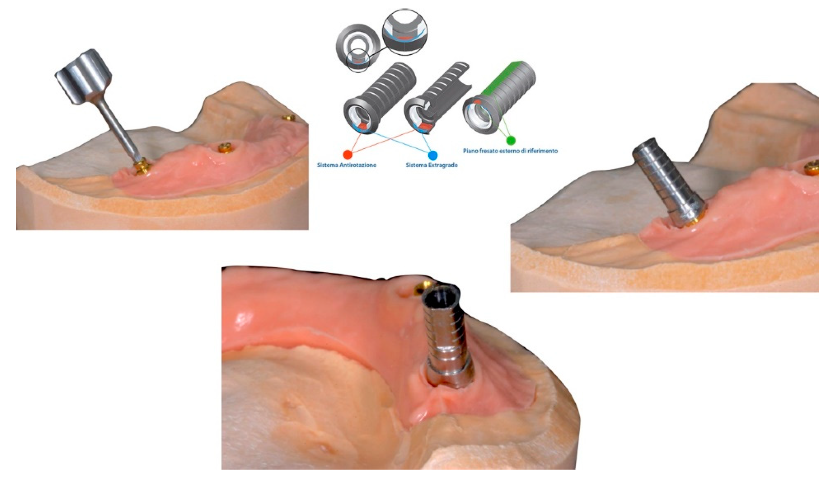 Prosthesis 02 00033 g002 Prosthesis 02 00033 g002