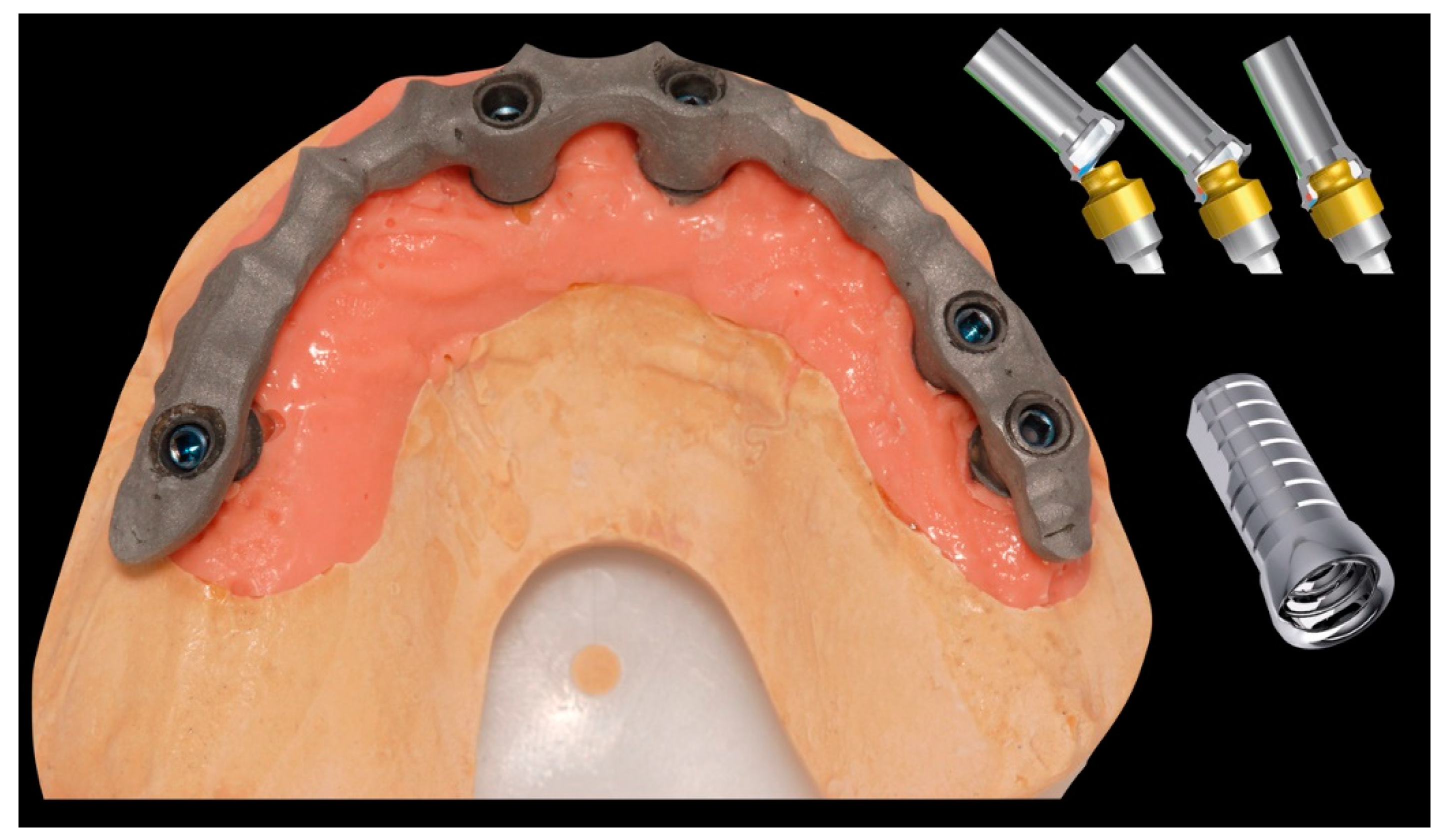 Prosthesis 02 00033 g004 Prosthesis 02 00033 g004