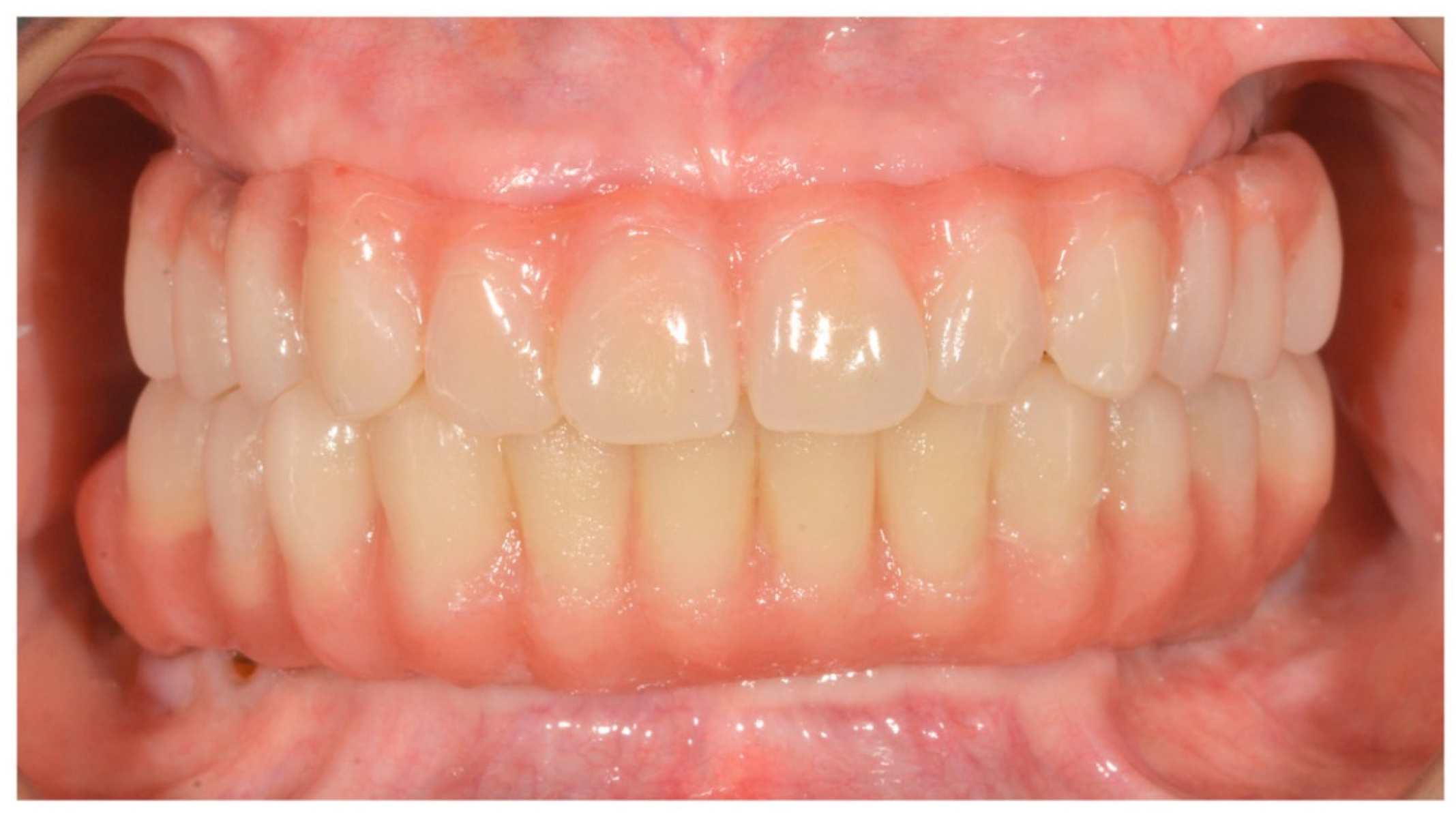 Prosthesis 02 00033 g005 Prosthesis 02 00033 g005